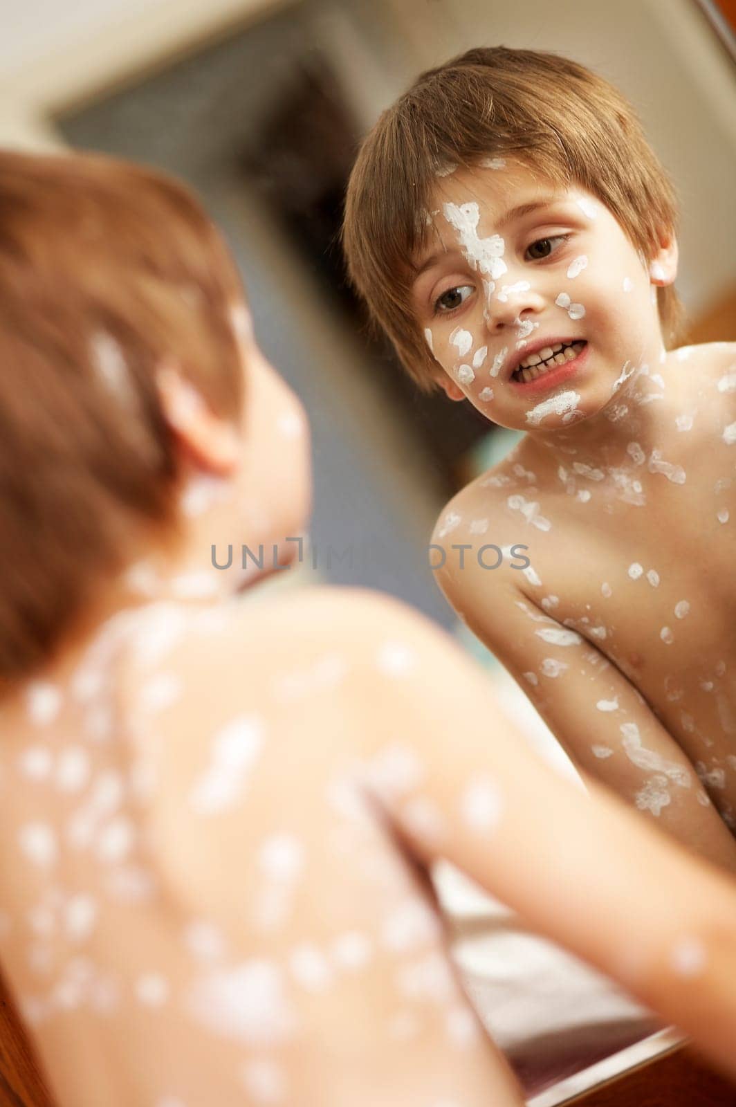Chickenpox IV.