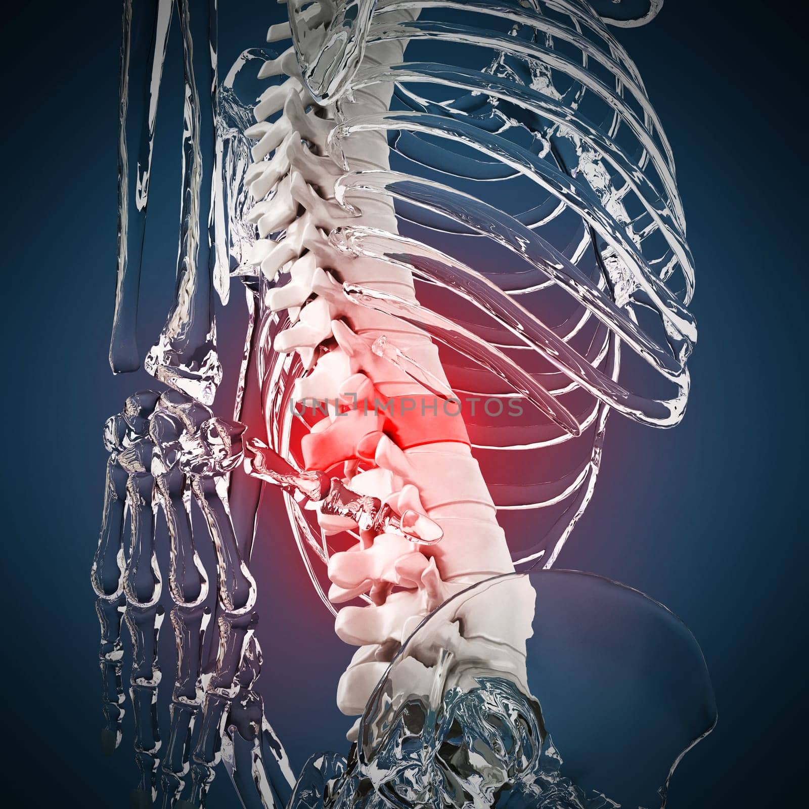 3D illustration showing back pain. 3D illustration.