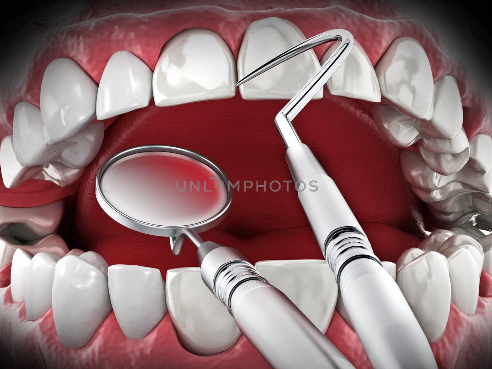 Professional dentist tools isolated on white background. 3D illustration.
