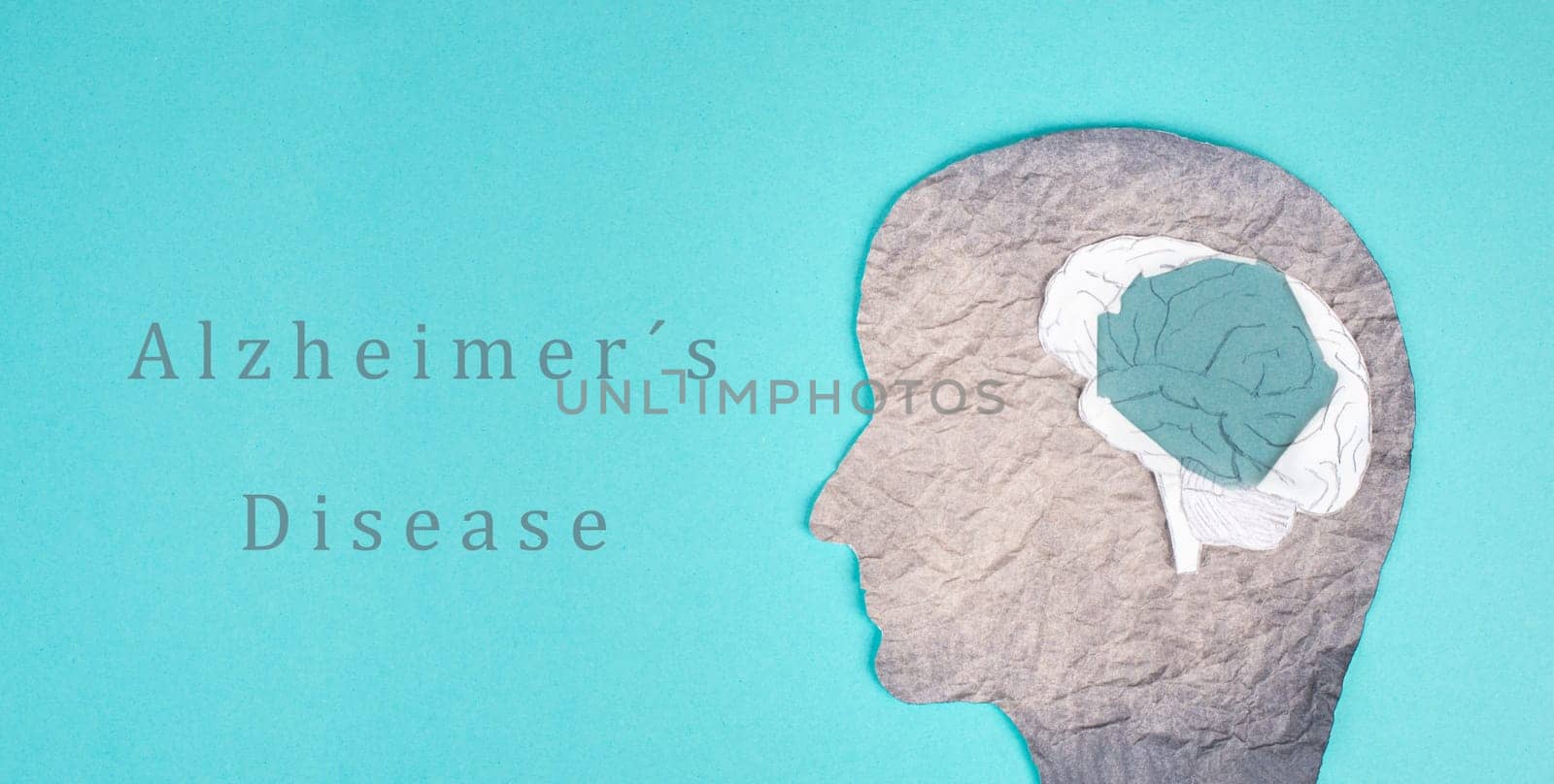 Alzheimer disease is standing on a paper, silhouette of a head with a damaged brain, dementia diagnosis, Parkinson´s awareness day