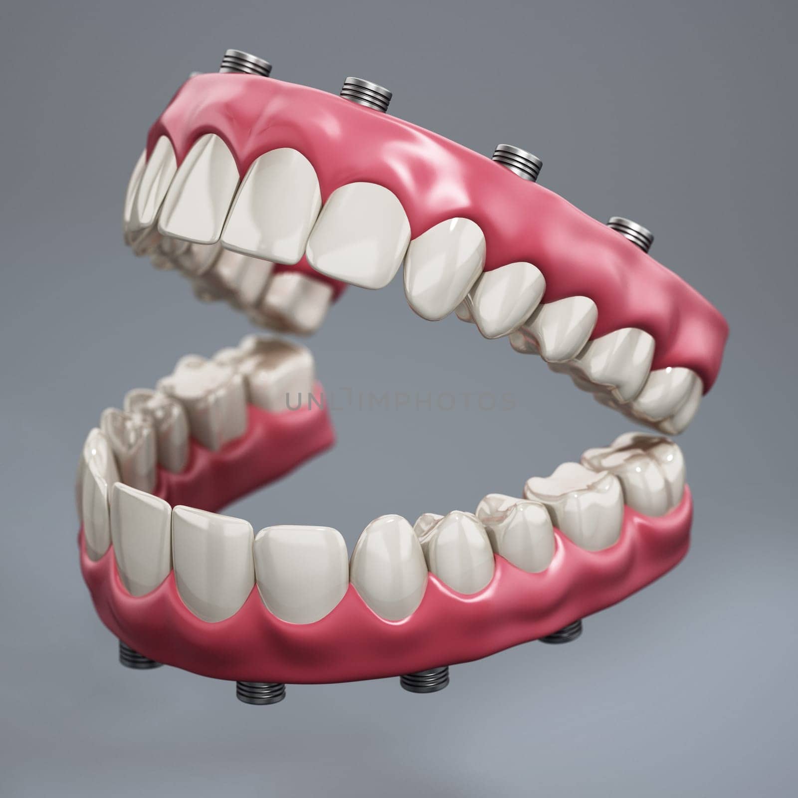 Dental prosthesis isolated on gray background. 3D illustration.