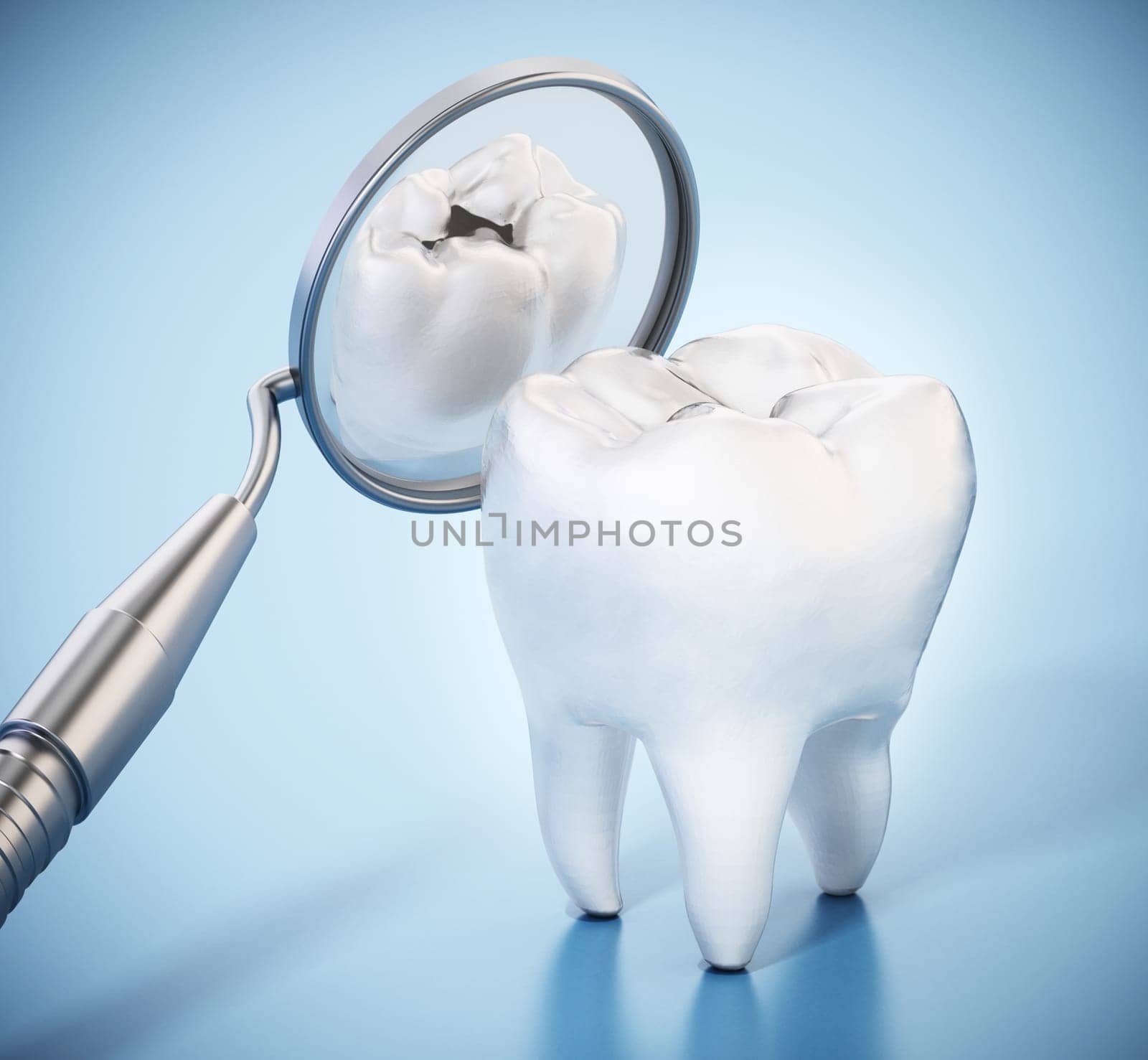 Dentist mirror showing the back of the isolated tooth. 3D illustration.