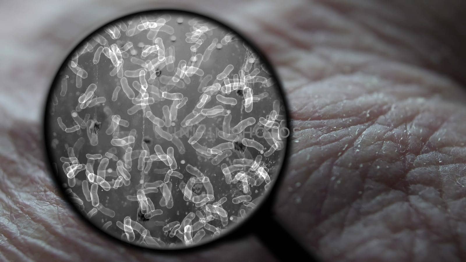 Searching for virus on human skin,Searching for virus on human skin