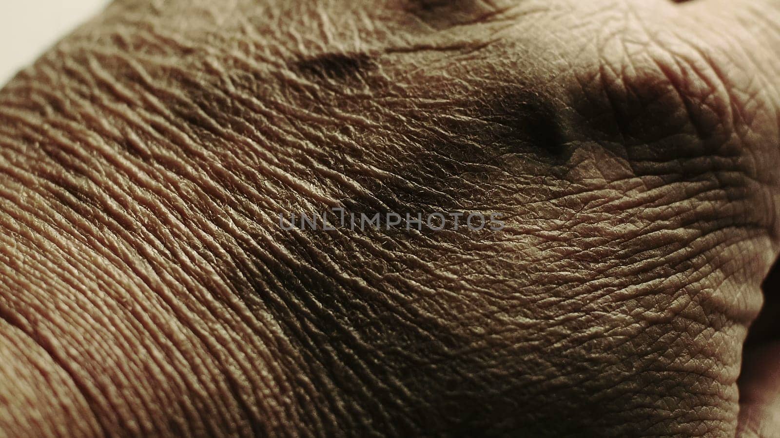 Close up of Senior's hands with Alzheimer disease