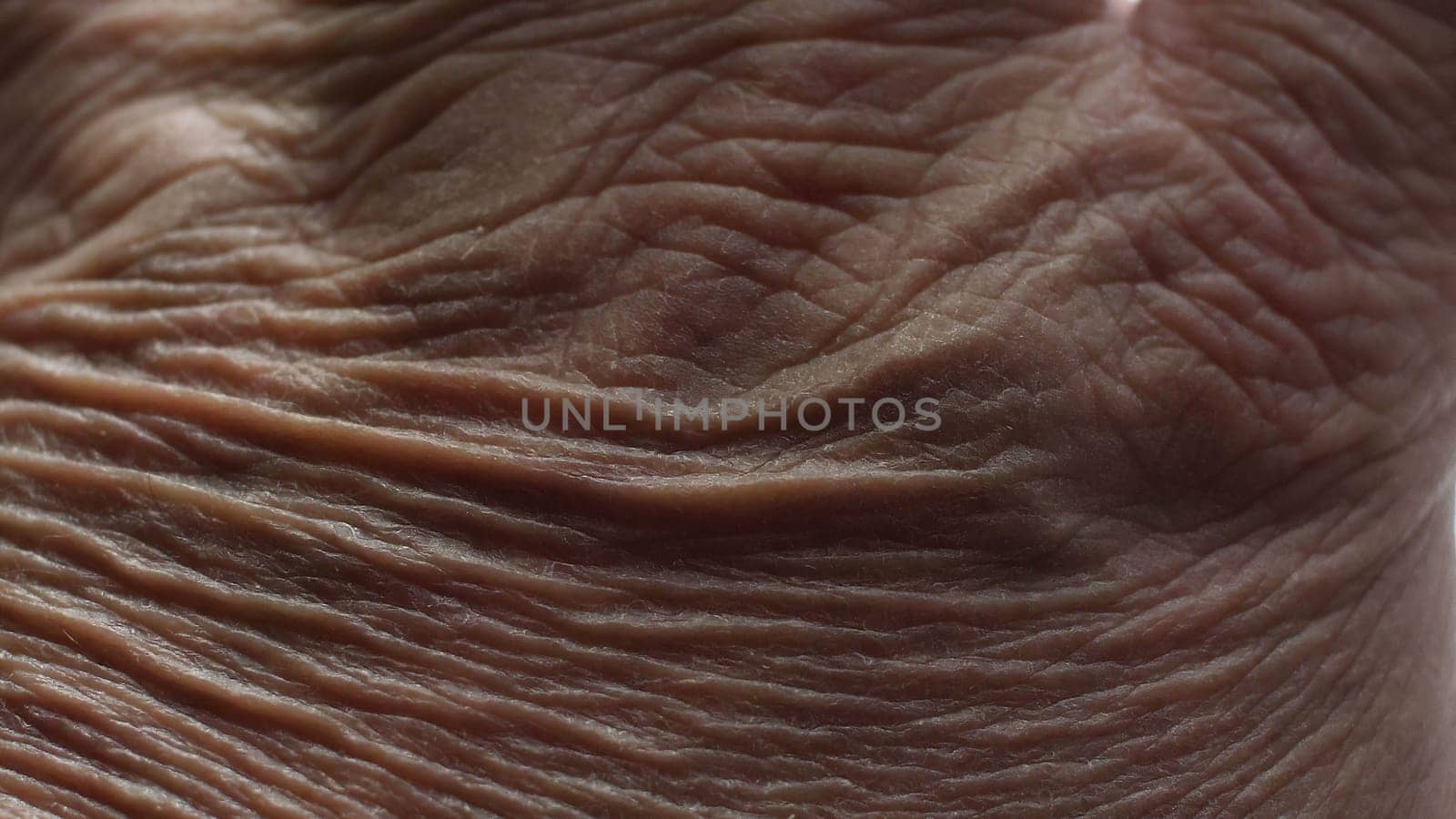 Close up of Senior's hands with Alzheimer disease