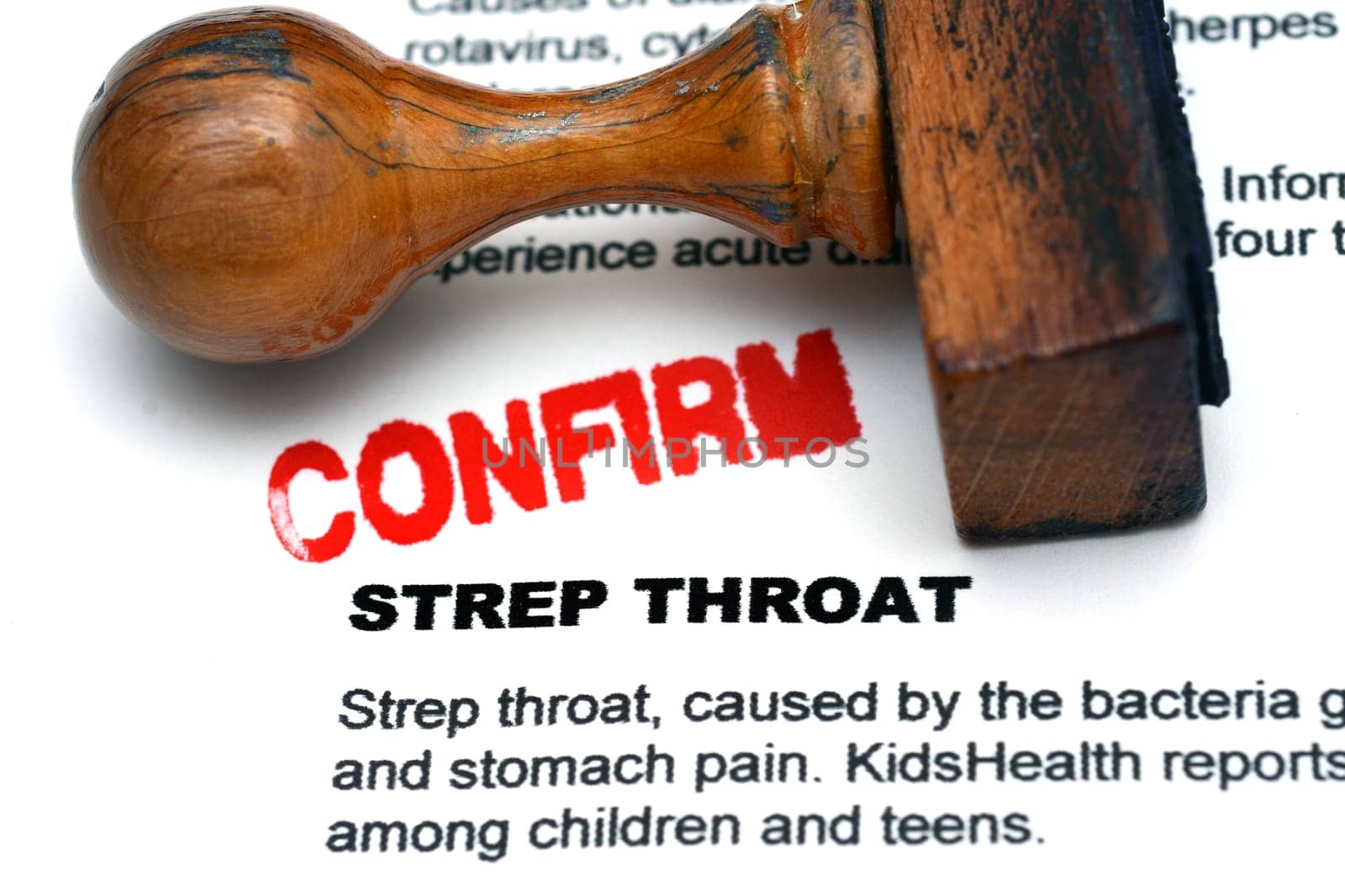 Strep throat confirm