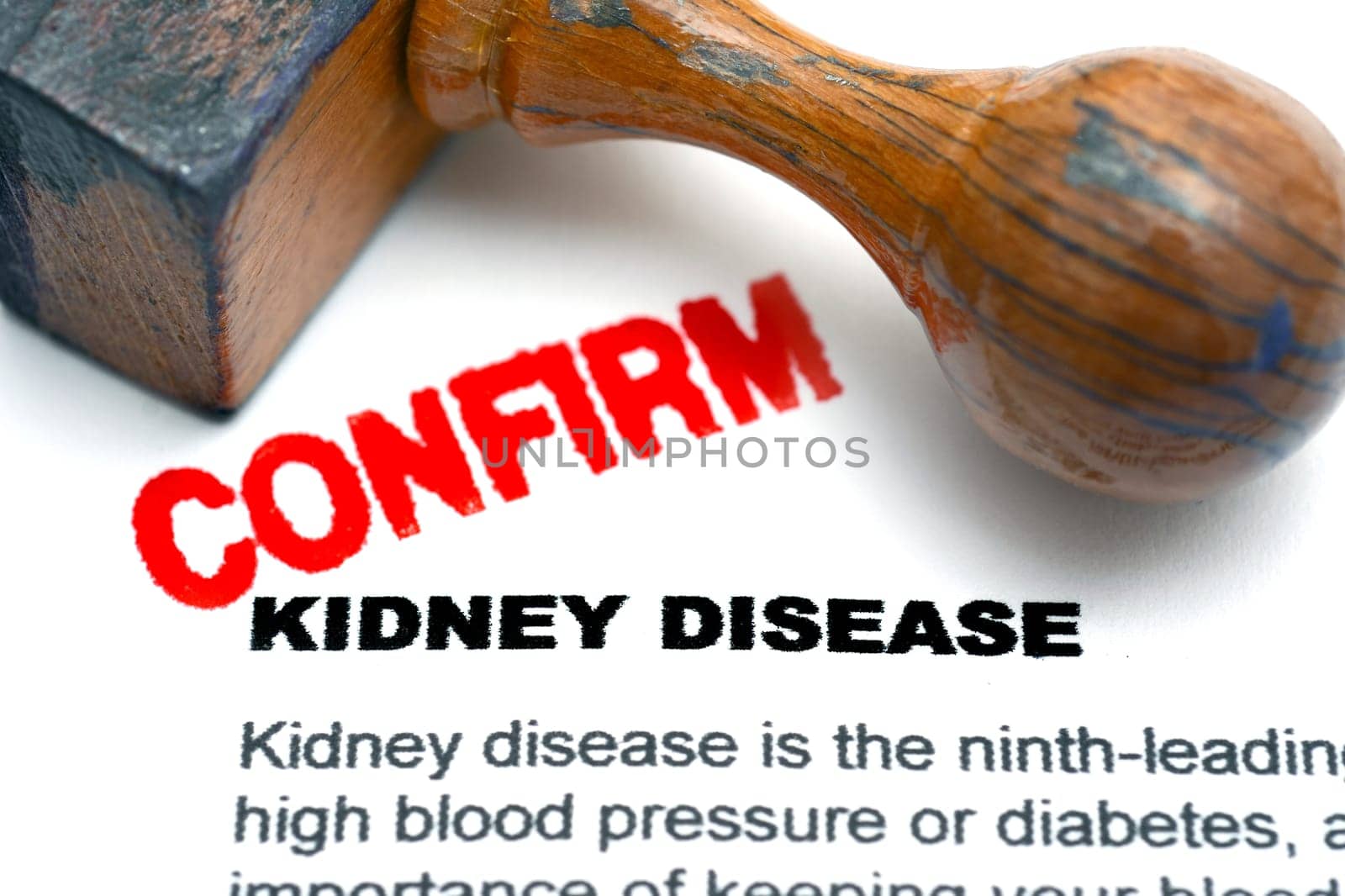 Kidney disease