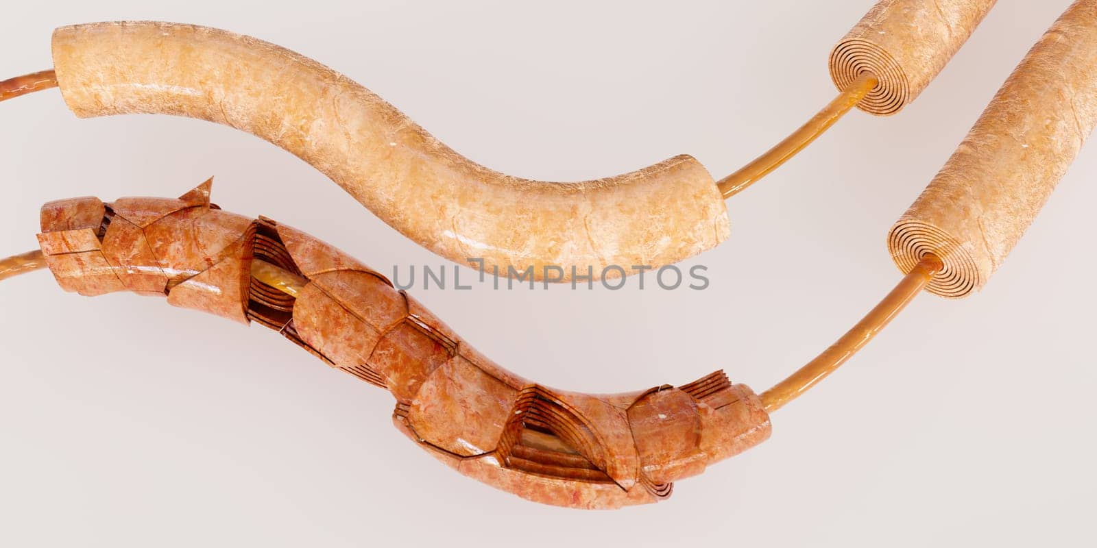 Healthy nerve next to a diseased nerve with GBS syndrome on a white background - 3D Rendering