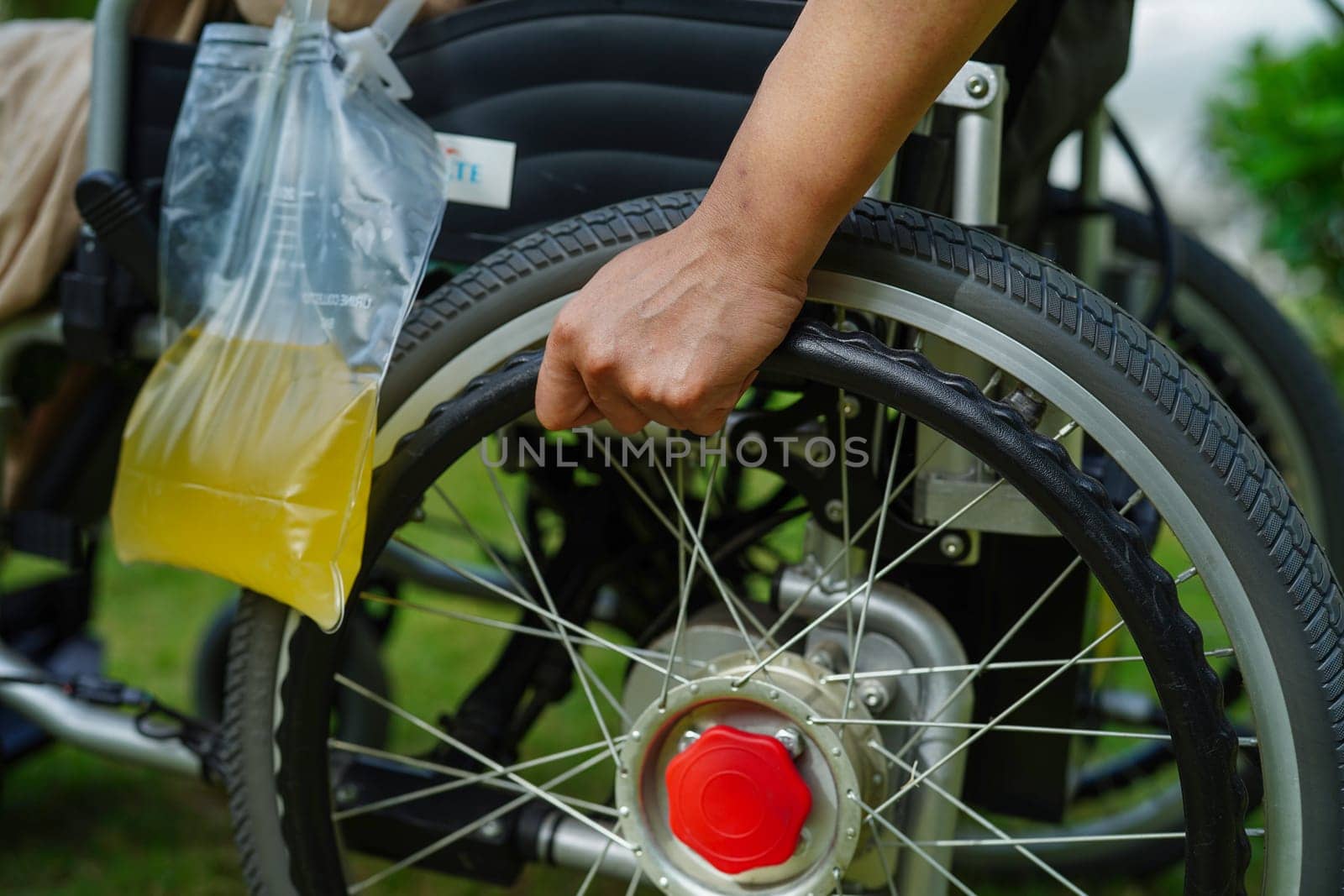 Asian disability woman with urine bag on wheelchair.