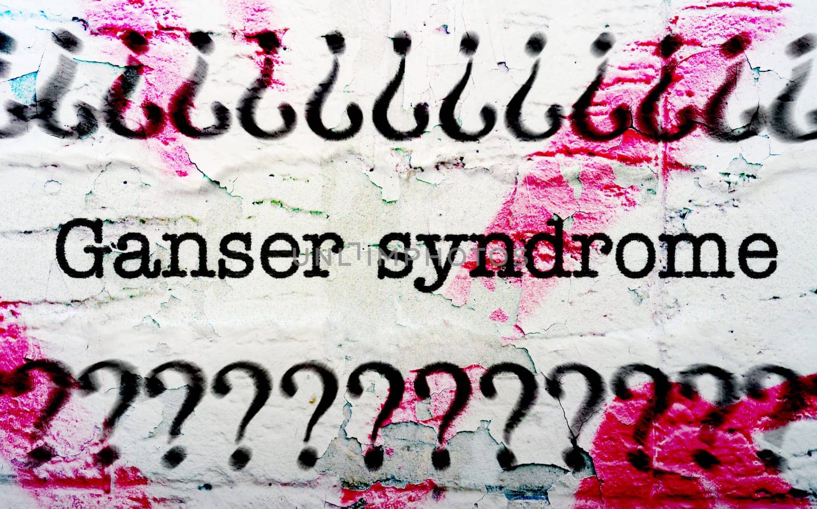 Ganser syndrome