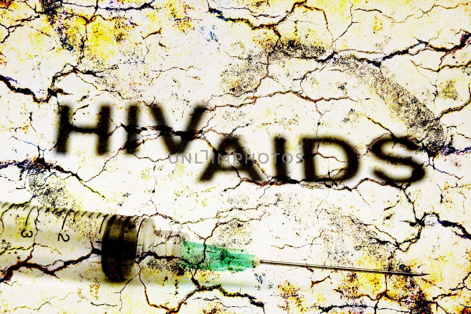 Hiv - Aids