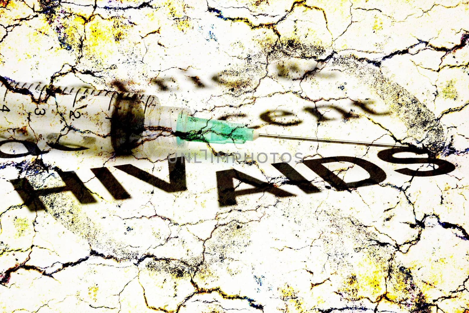 Hiv - Aids