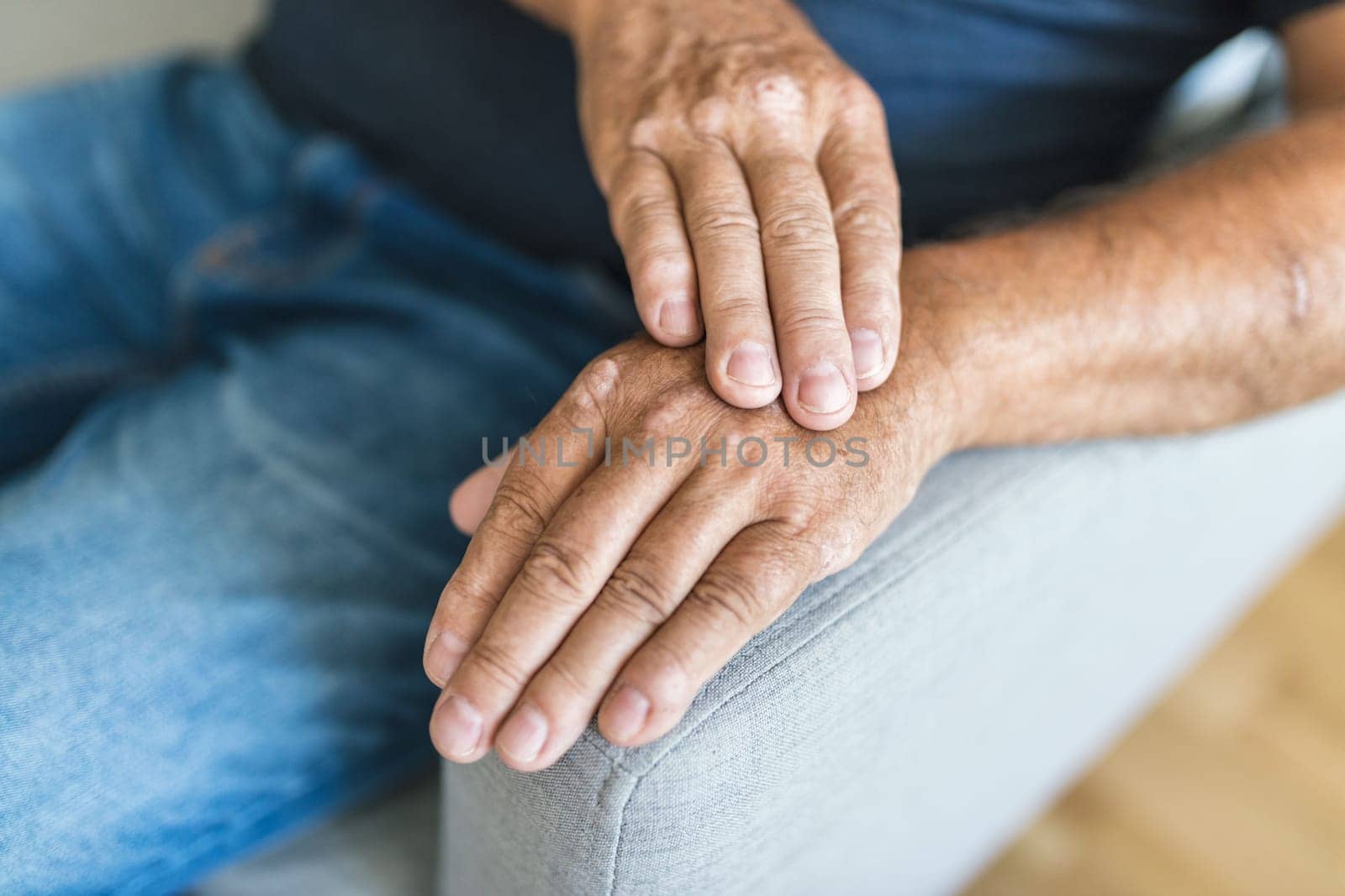 Elderly man suffering from psoriasis, closeup on hands