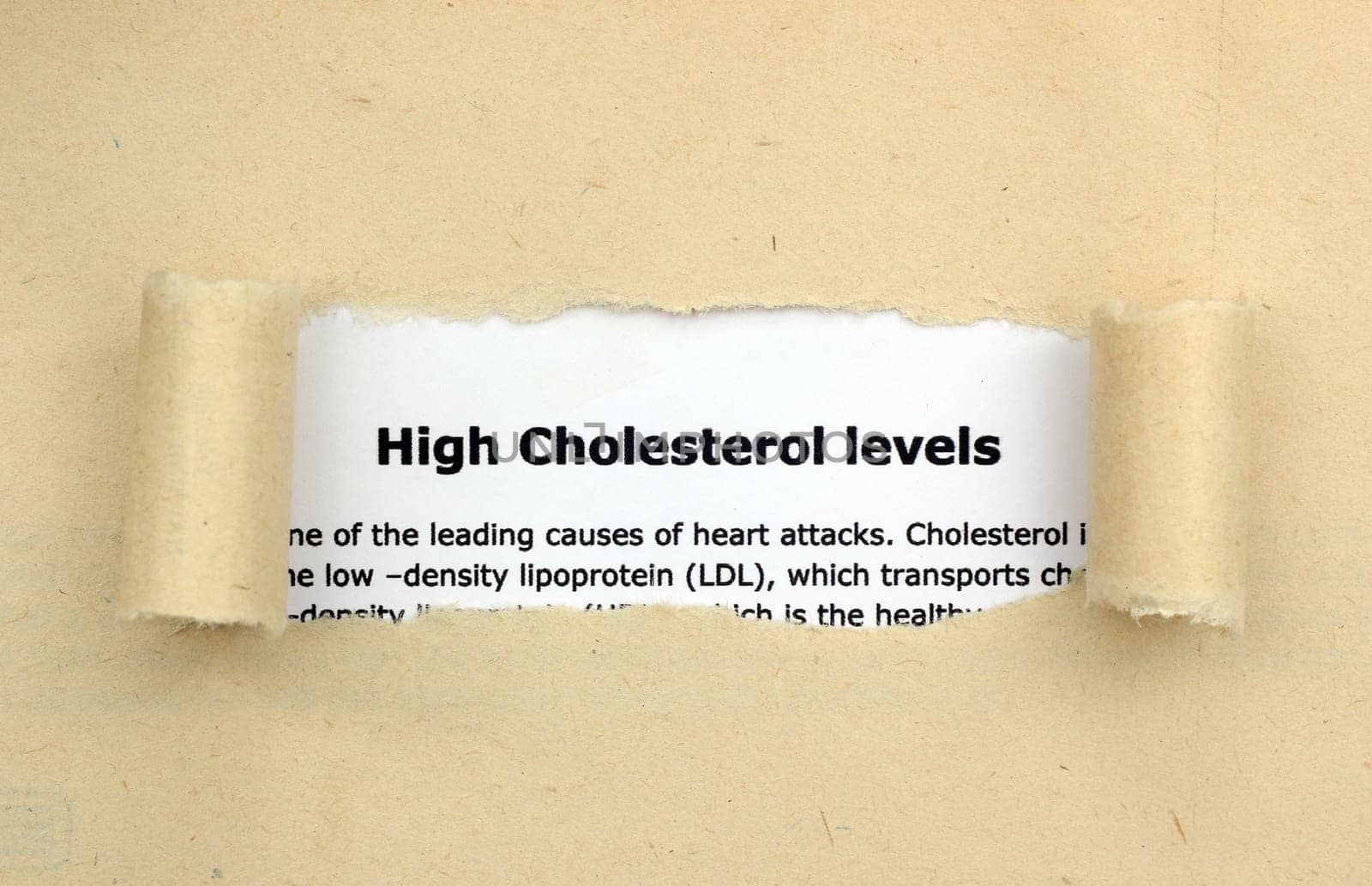High cholesterol levels