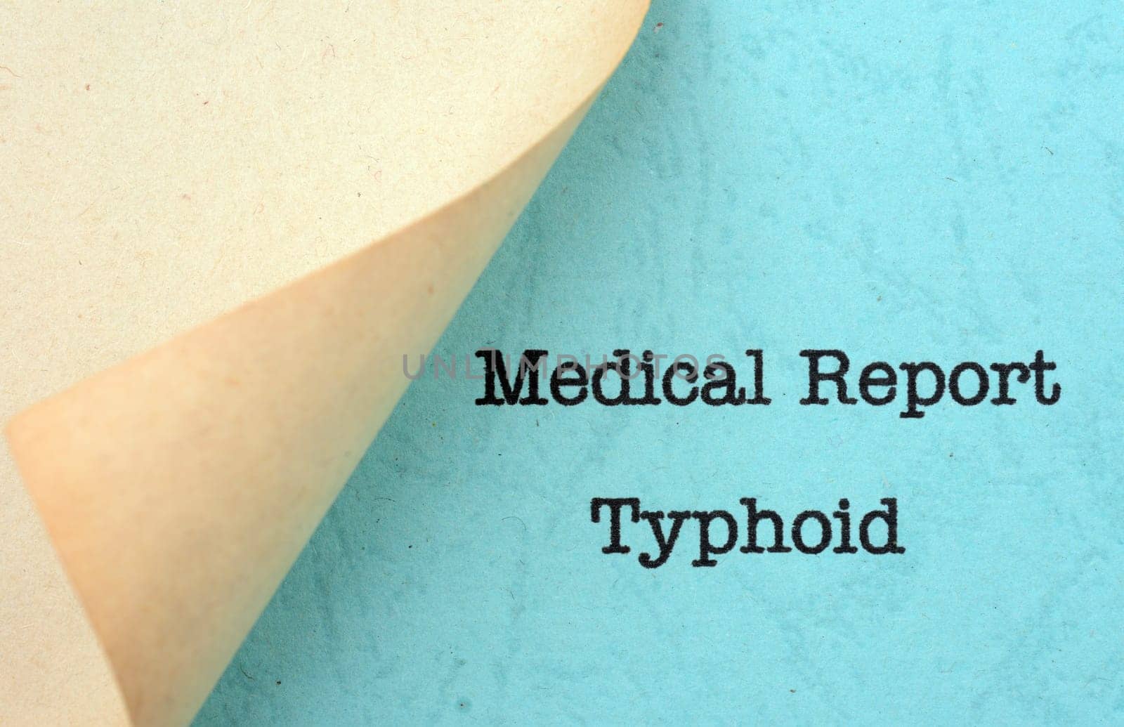 Typhoid