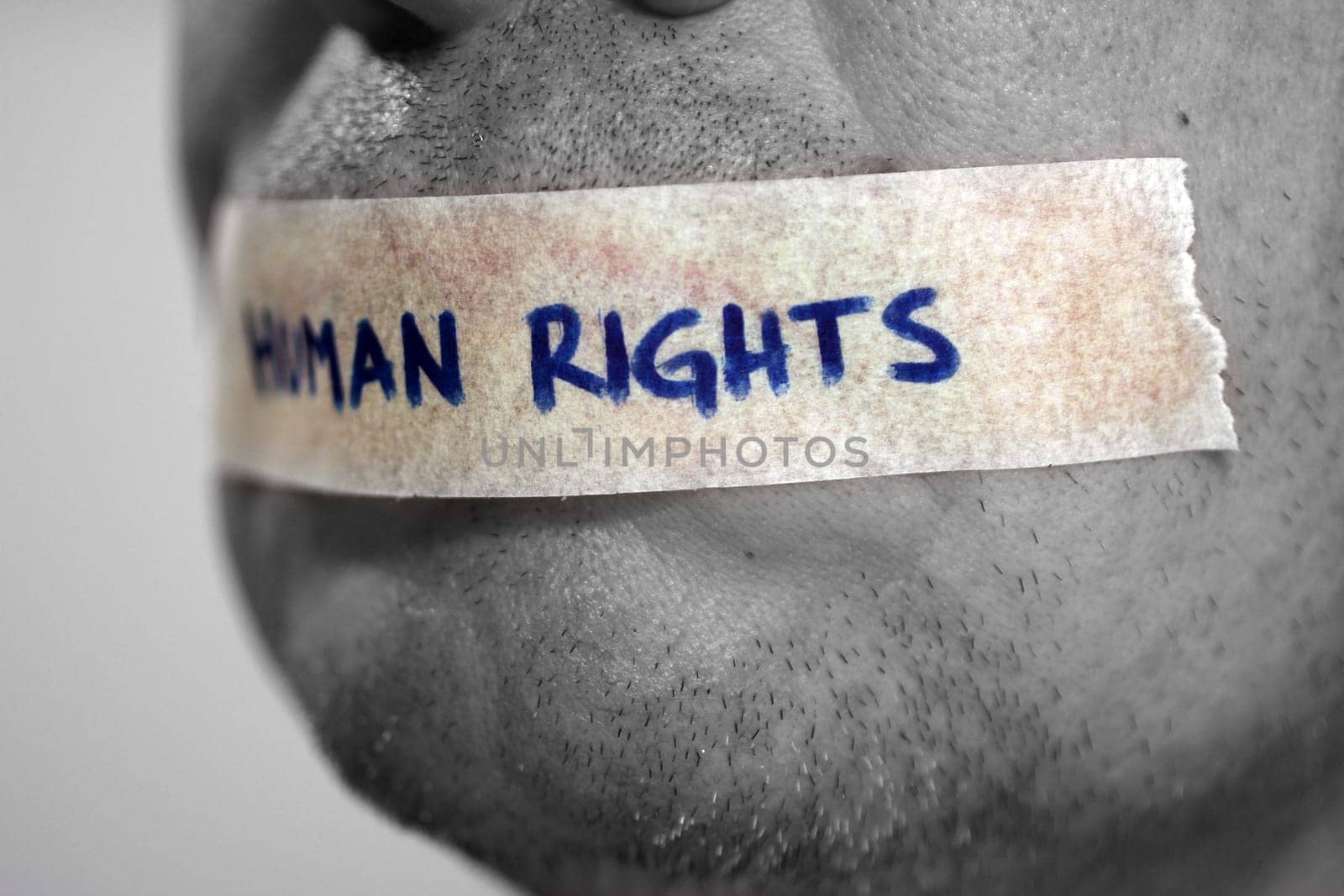 Human rights