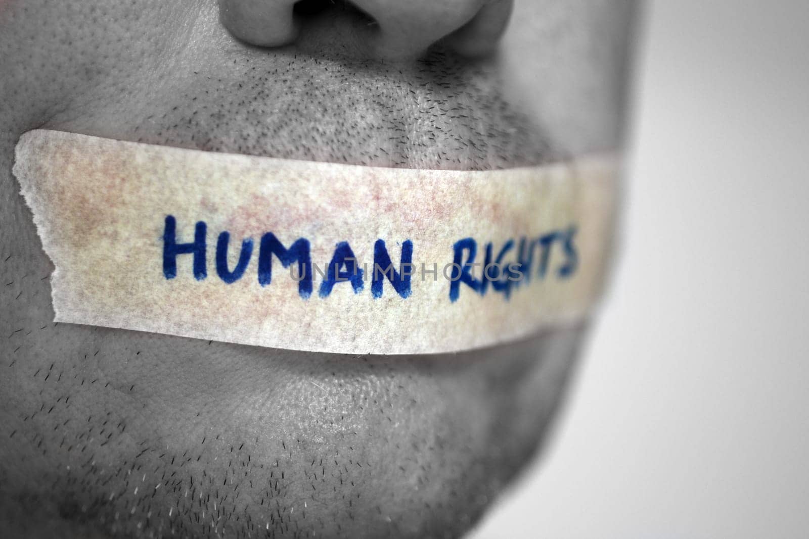 Human rights