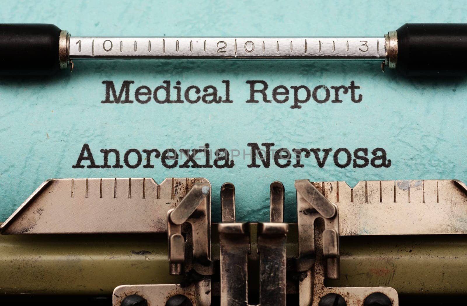 Anorexia nervosa