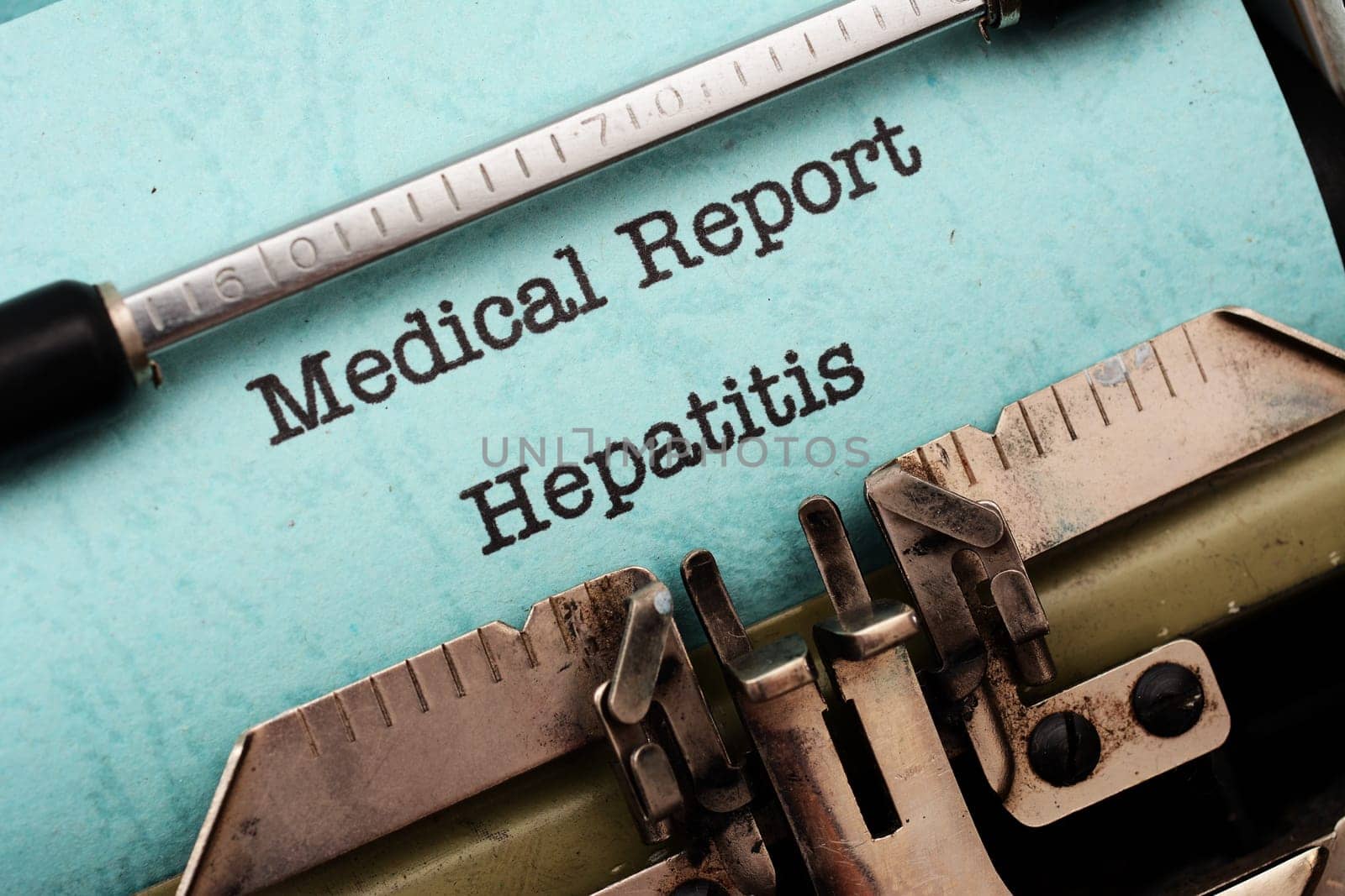 Hepatitis