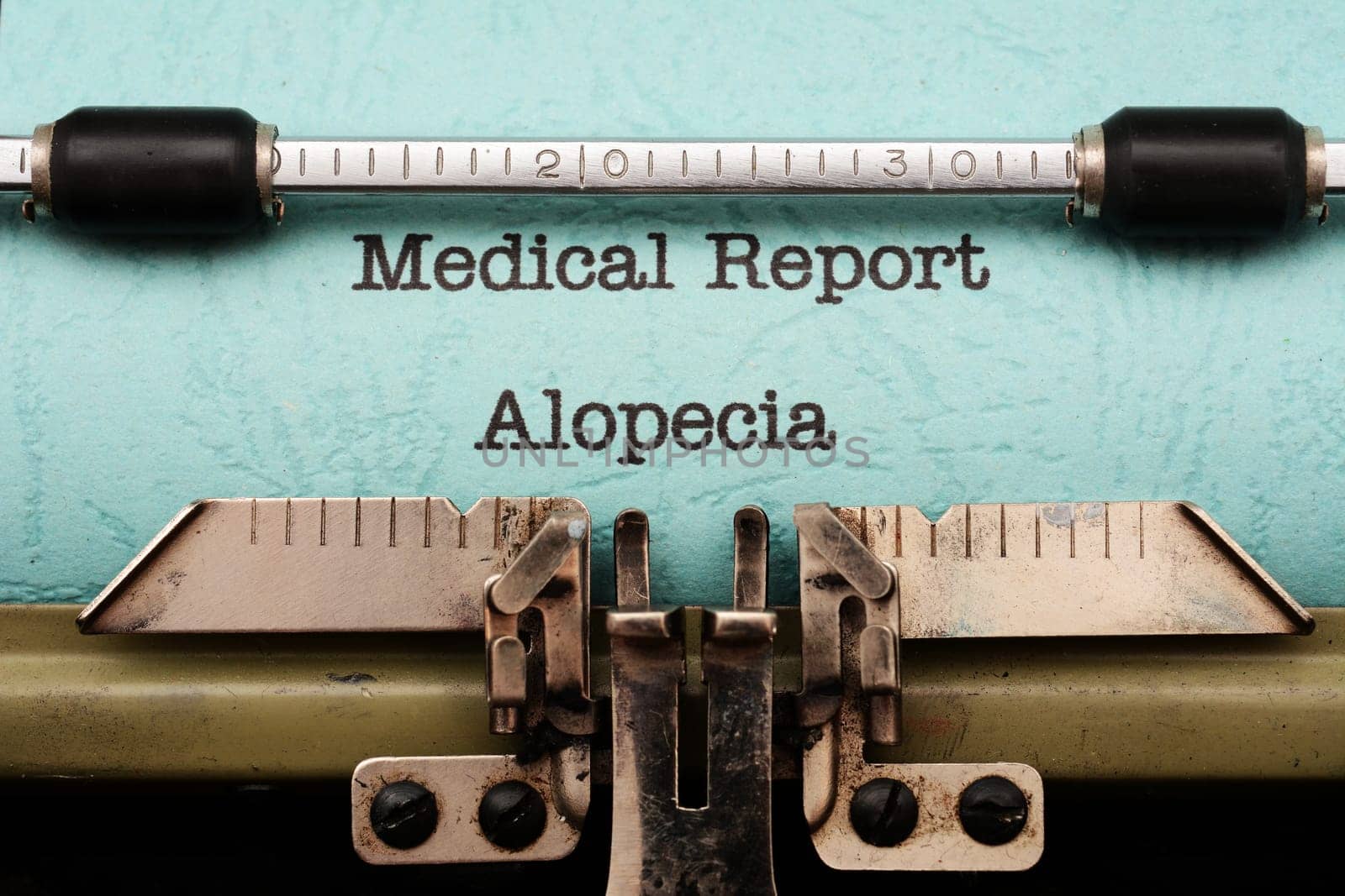 Alopecia