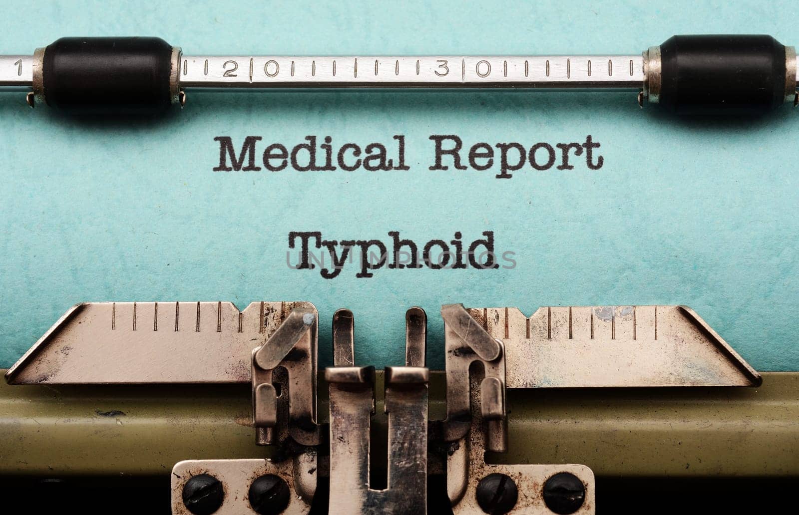Typhoid