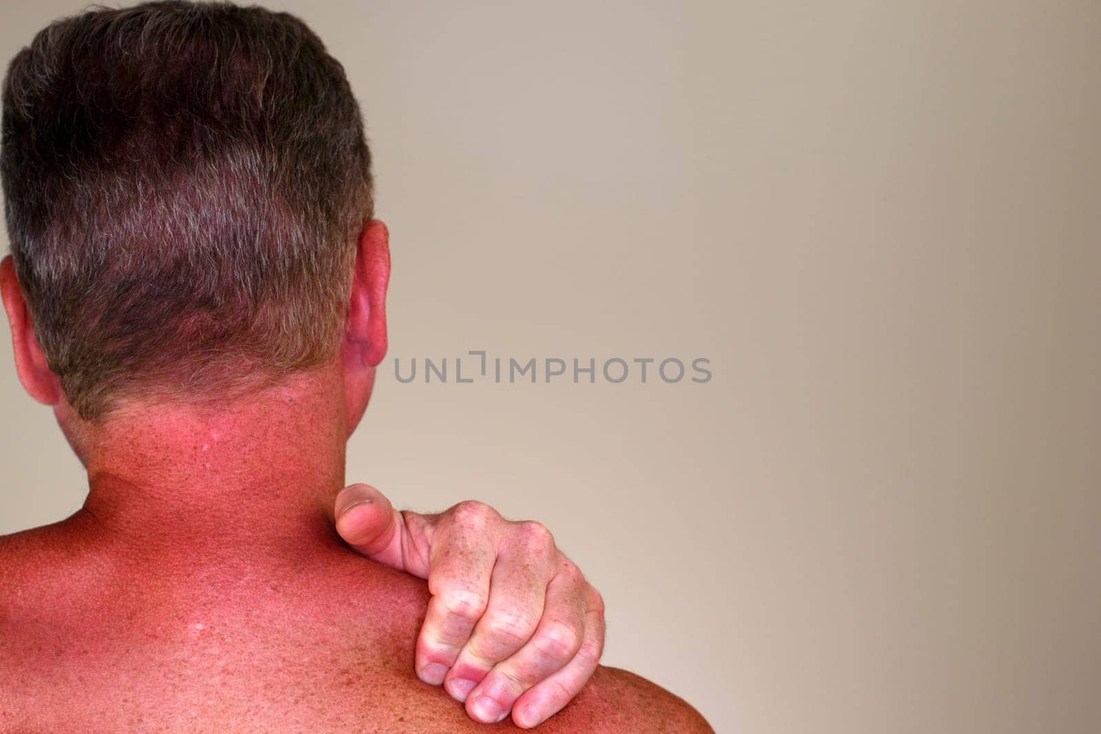 Mature male seen from behind massaging his naked right shoulder with his left hand close-up in front of a wall. Rear view of a left hand of a mature male massaging his right naked shoulder close-up