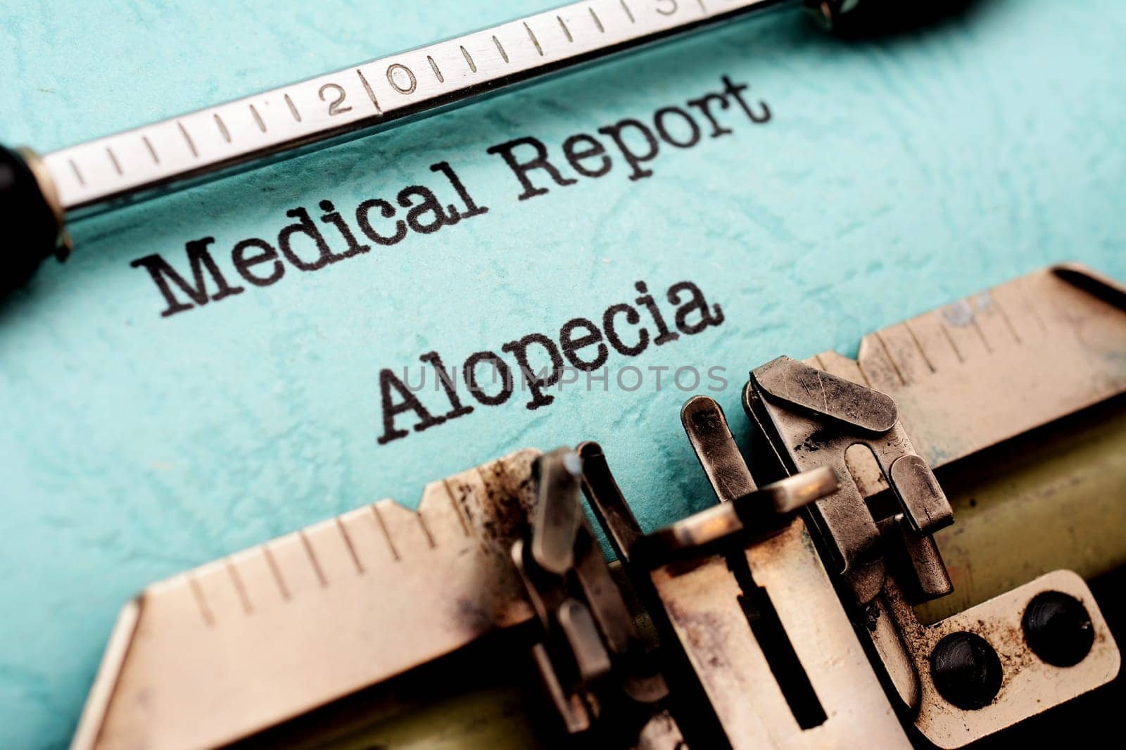 Alopecia