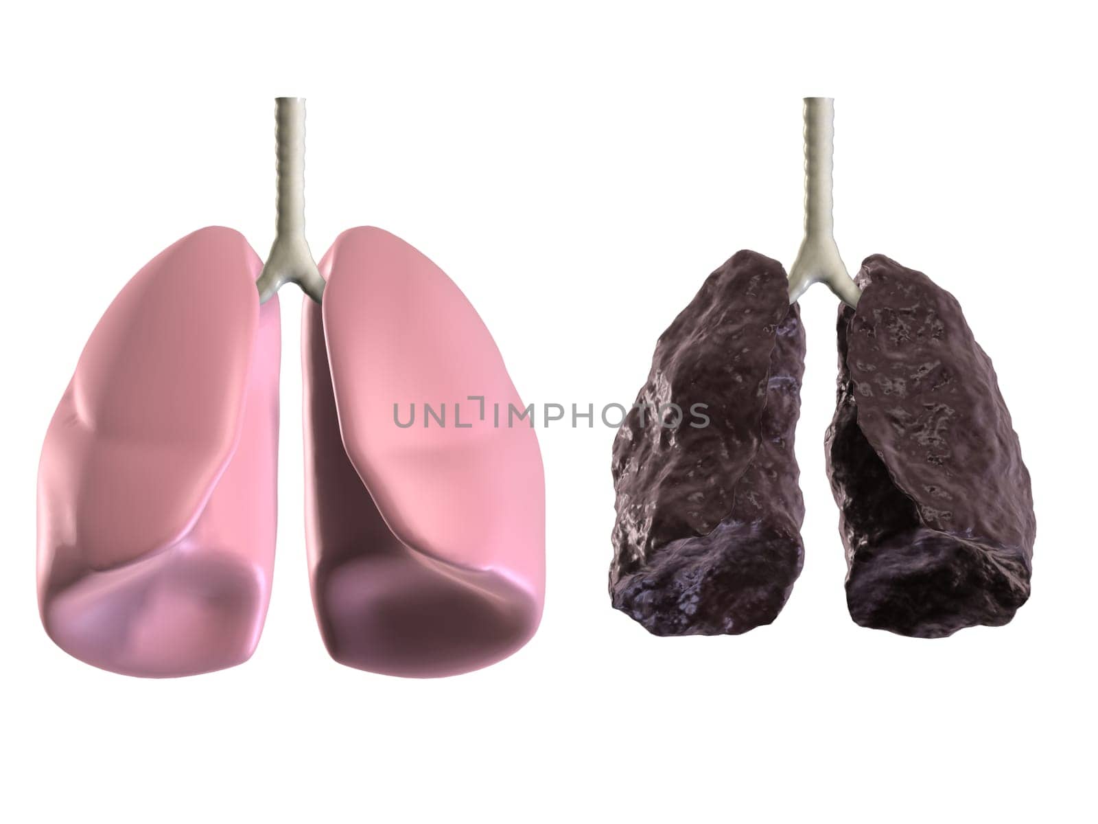3d rendered anatomy illustration of a healthy and a bad lung