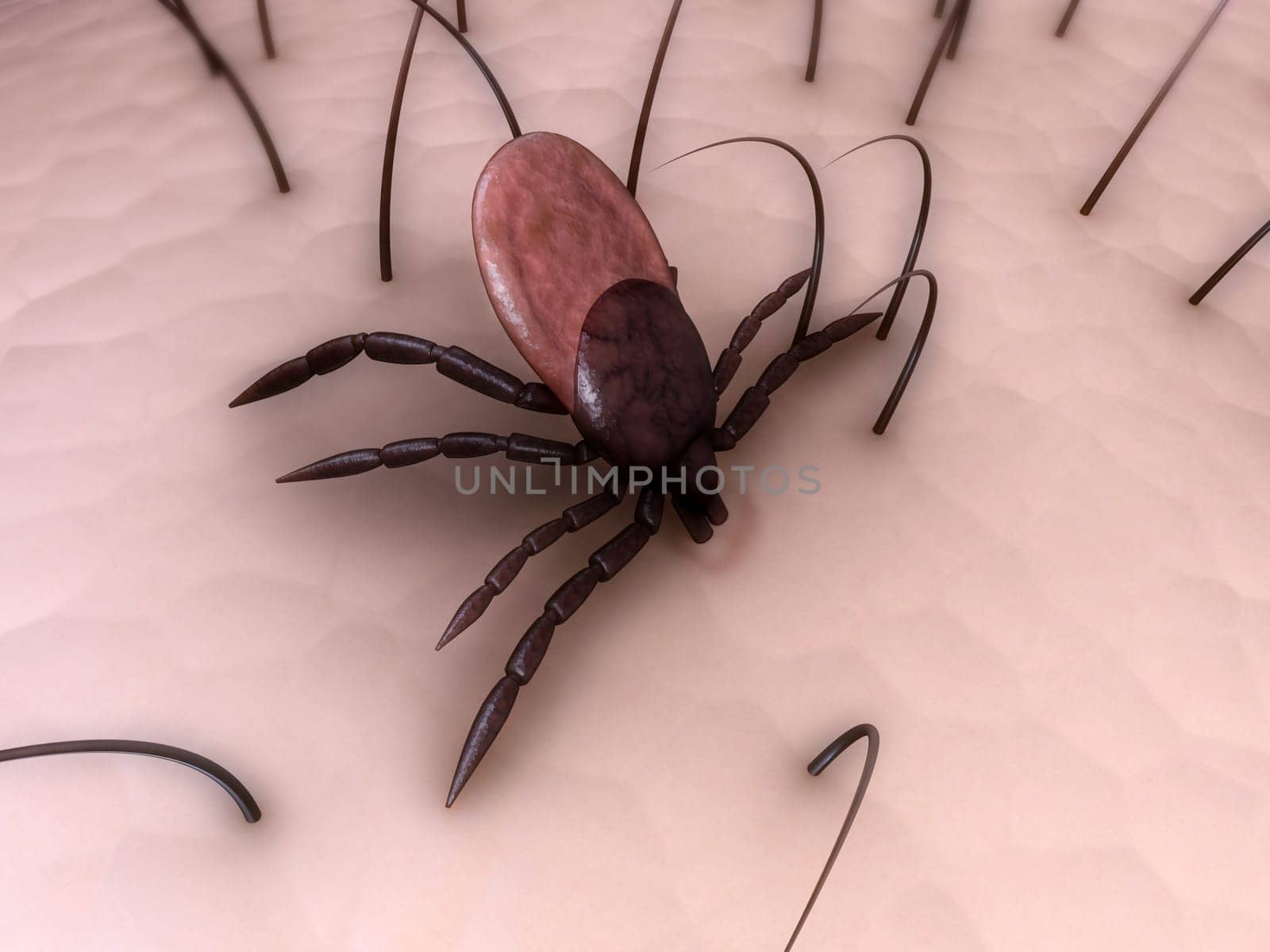 3d rendered illustration of a tick on the skin