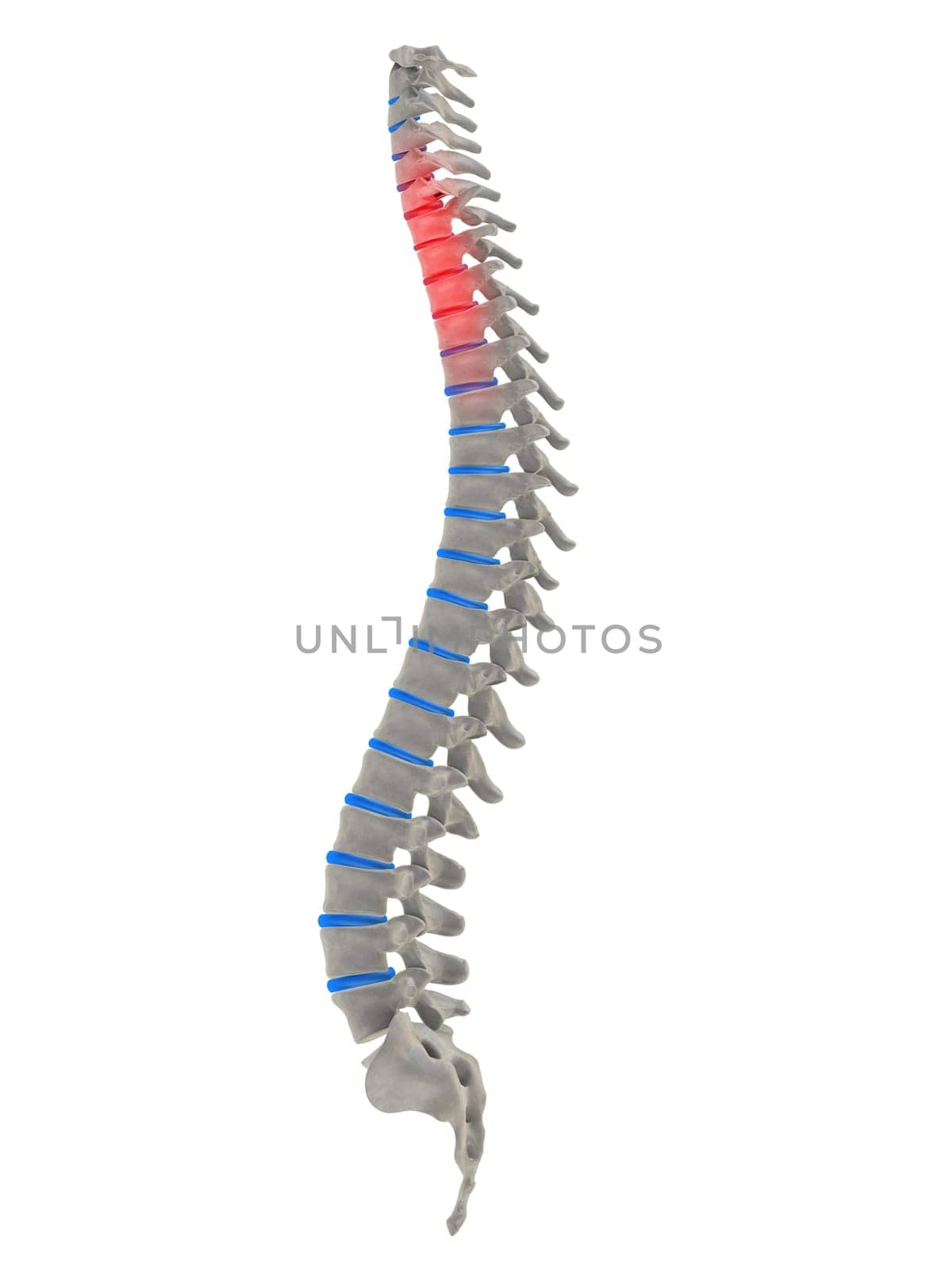 3d rendered anatomy illustration of a human spine with pain