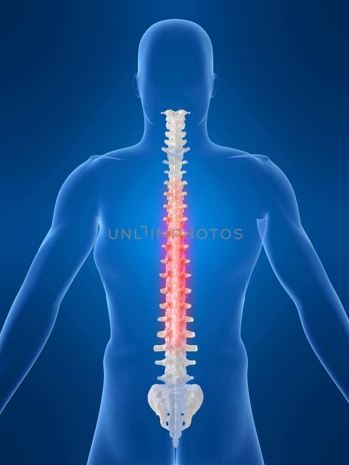 3d rendered anatomy illustration of a human spine with pain