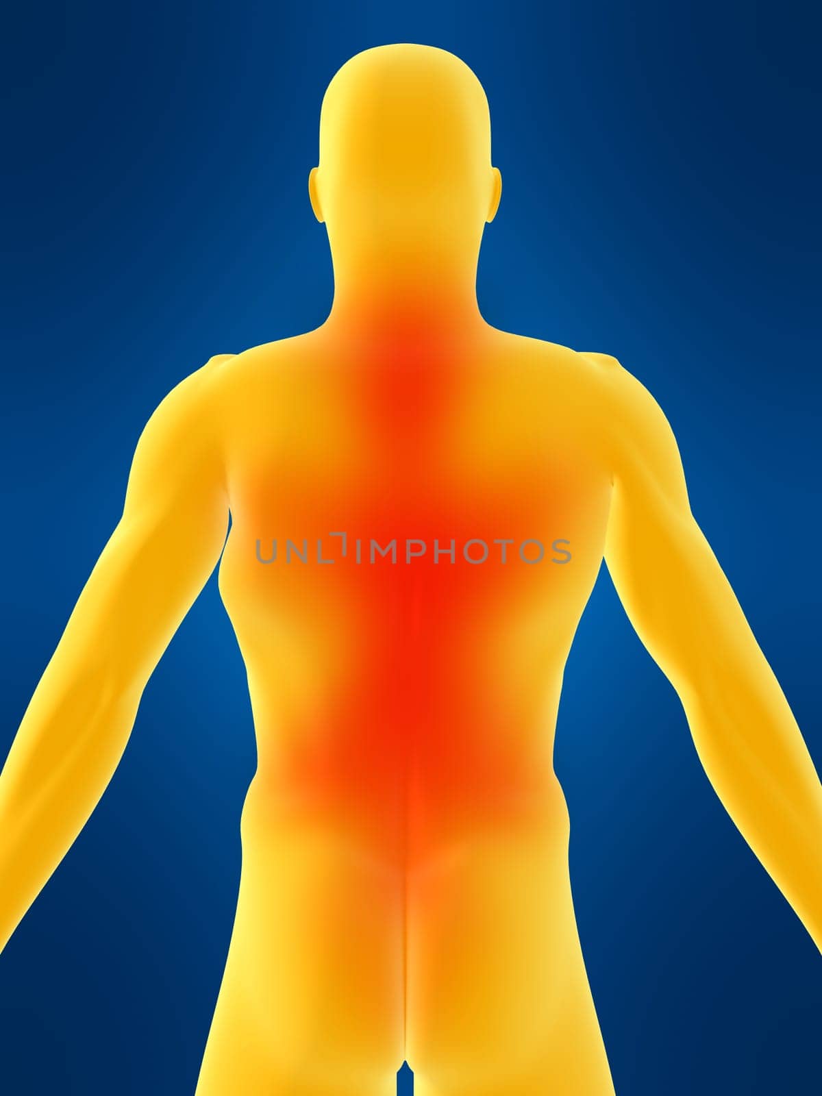 3d rendered anatomy illustration of a painful backbone