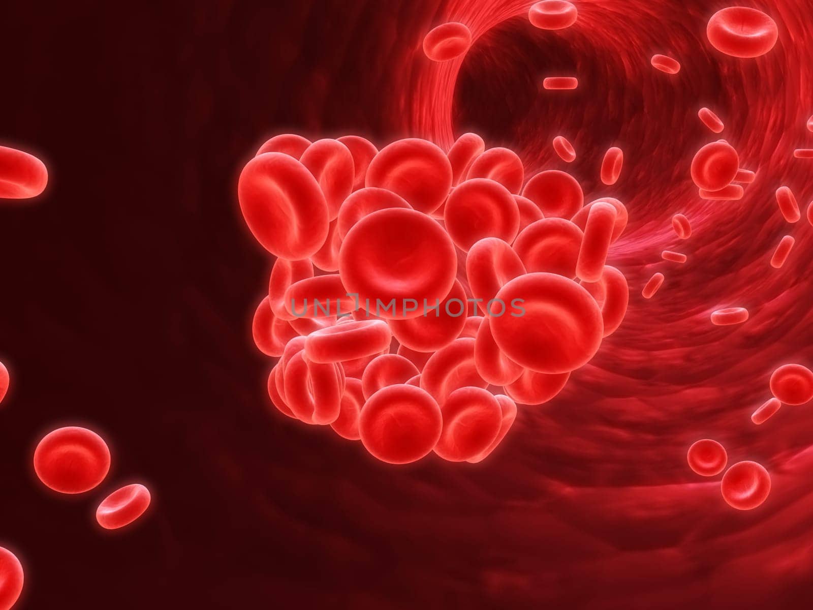3d rendered illustration of an artery with a blood clot