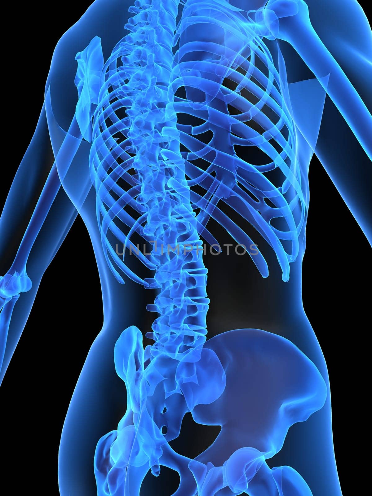 3d rendered x-ray illustration of a human skeletal back