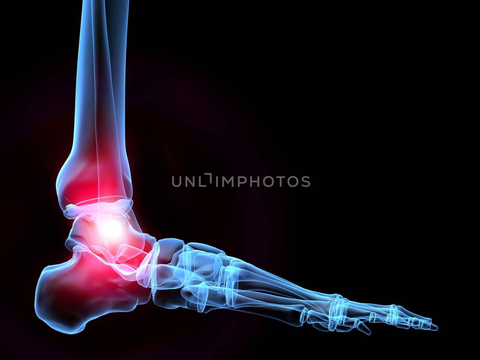 3d rendered x-ray illustration of a human foot with pain