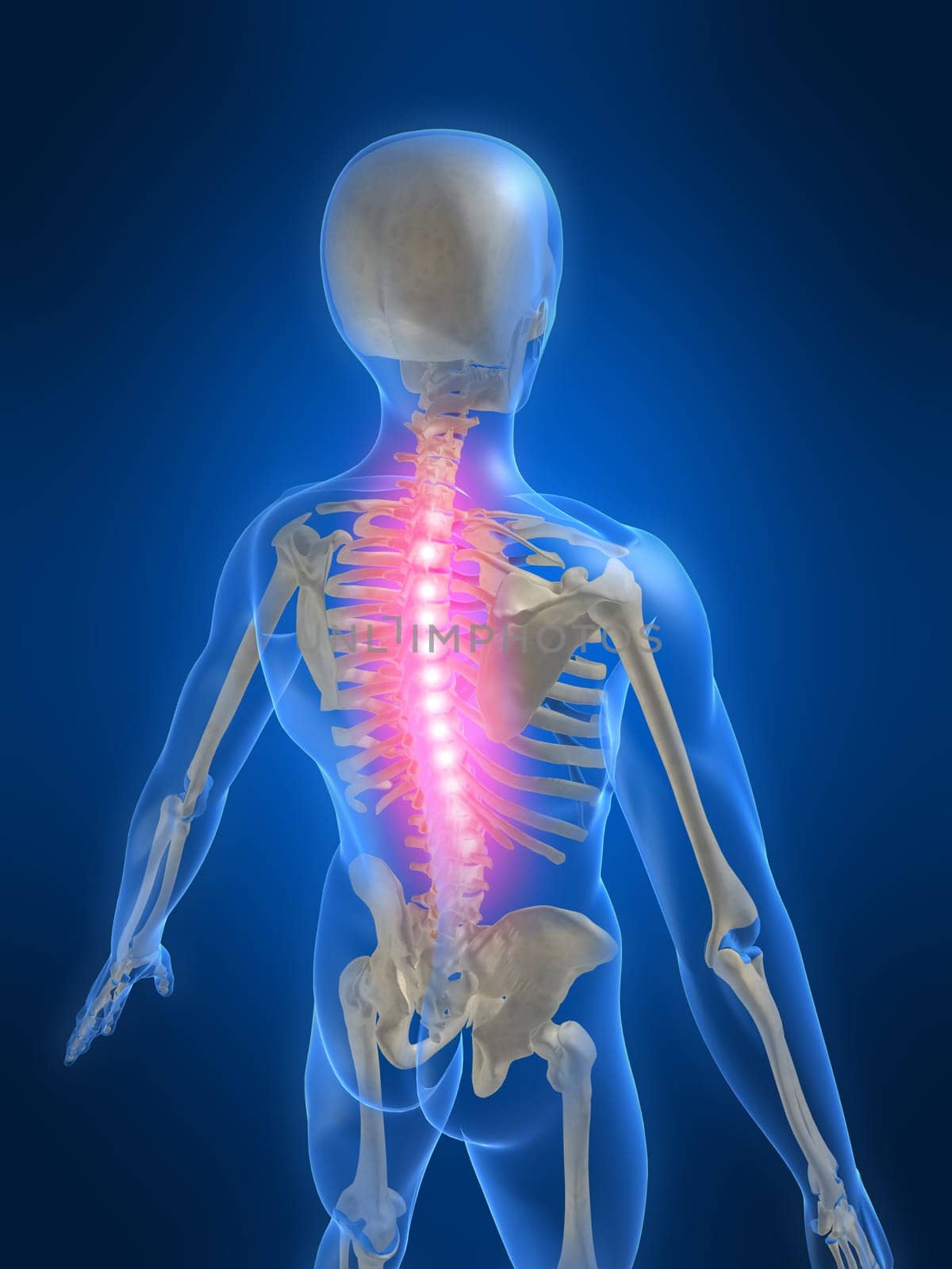 3d rendered anatomy illustration of a human skeleton with a painful spine