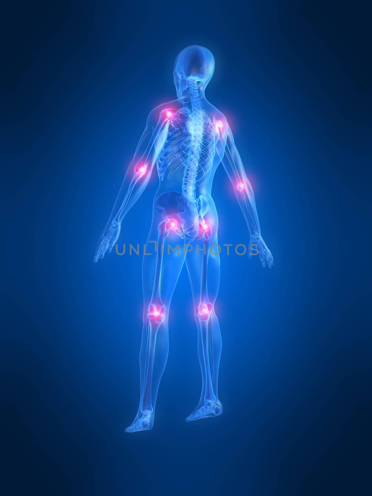 3d rendered anatomy illustration of a human skeleton with painful joints
