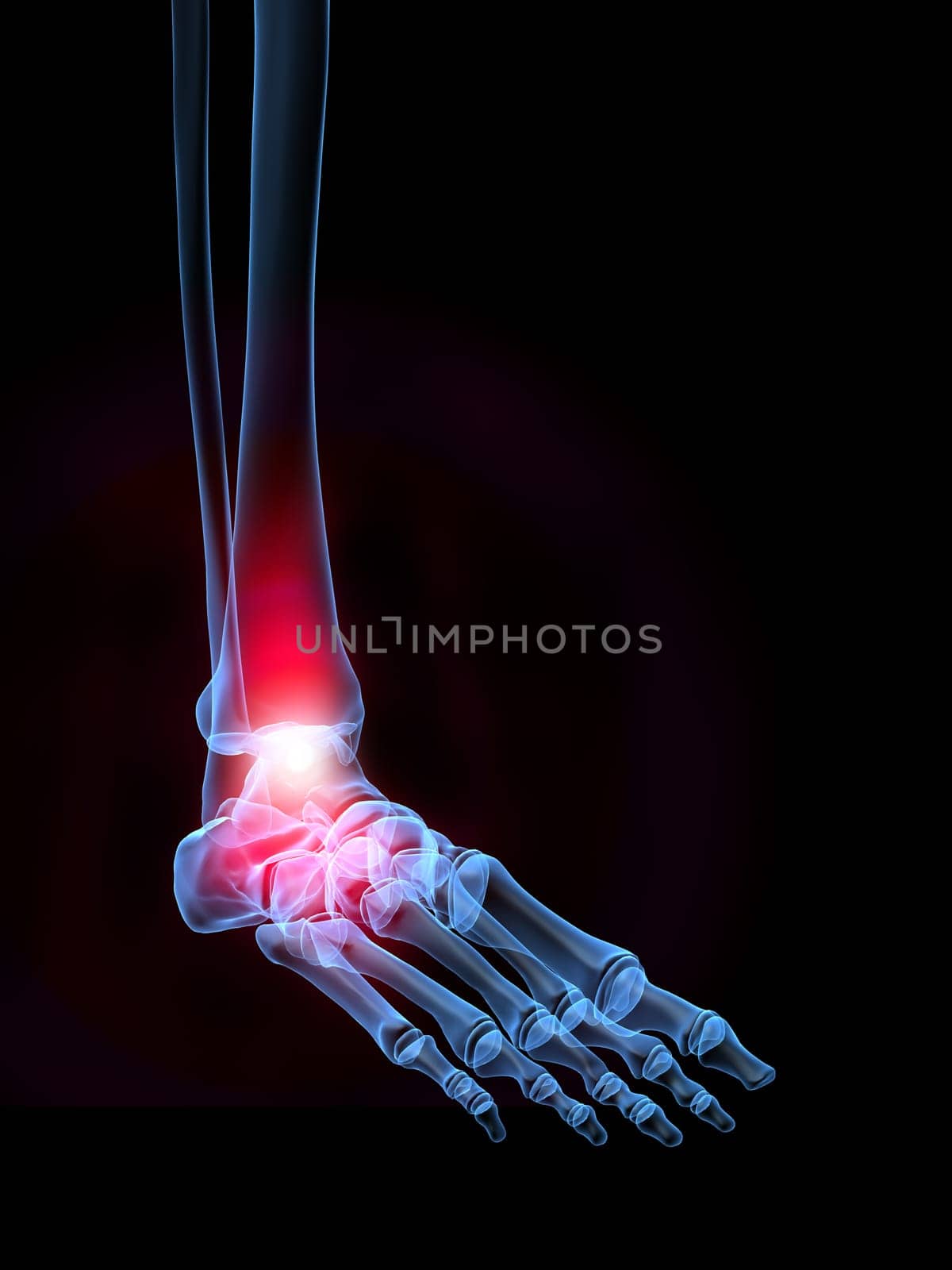 3d rendered x-ray illustration of a human foot with pain