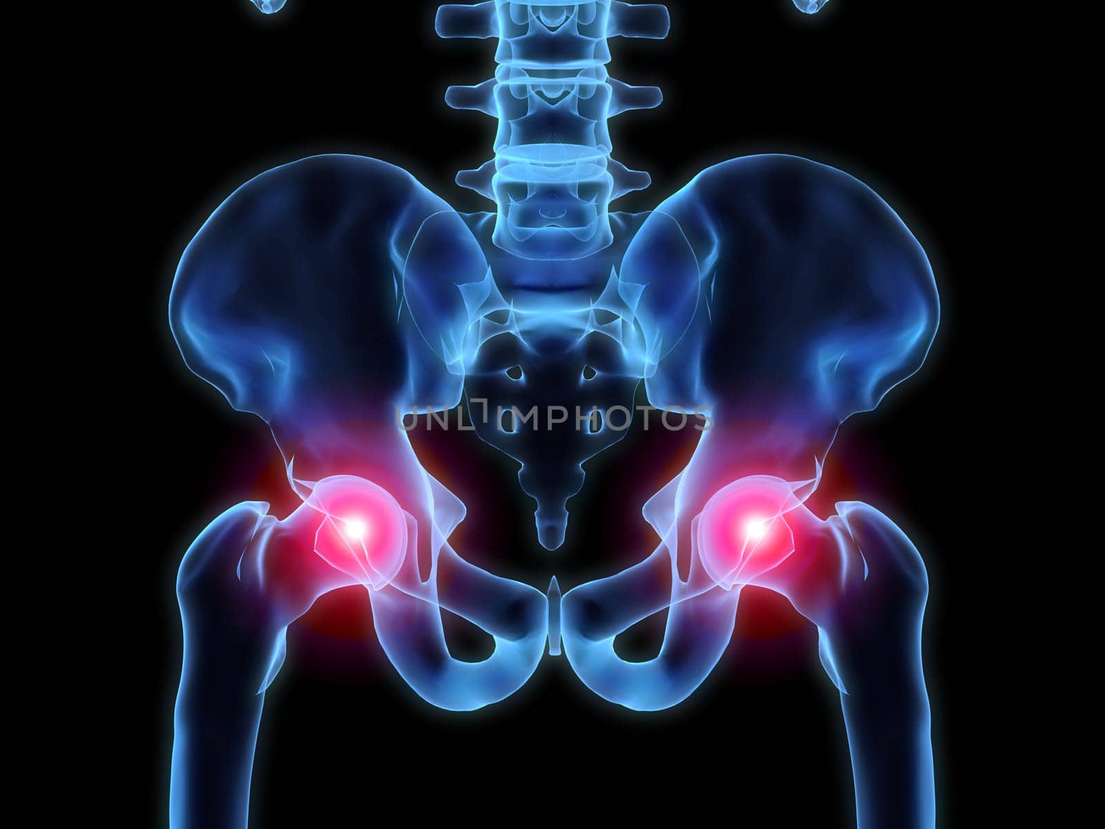 3d rendered anatomy illustration of human hips with pain