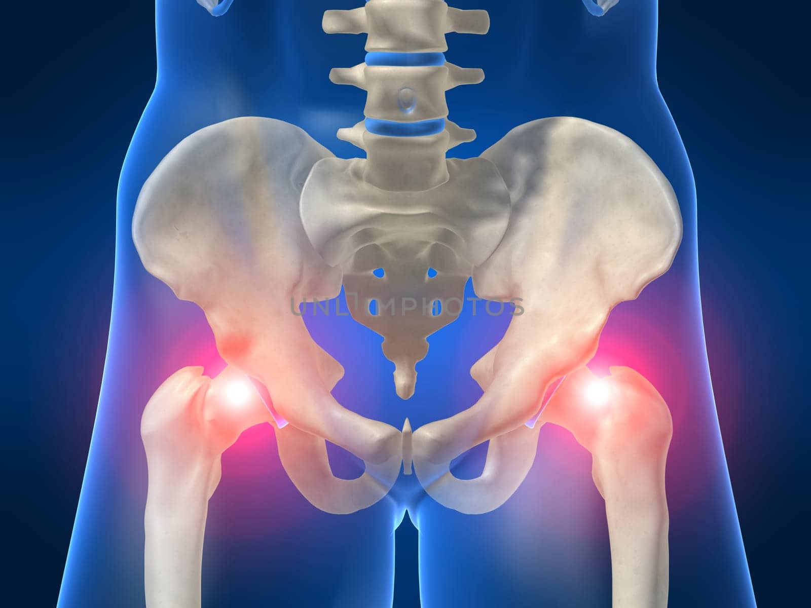 3d rendered anatomy illustration of  human hips with pain