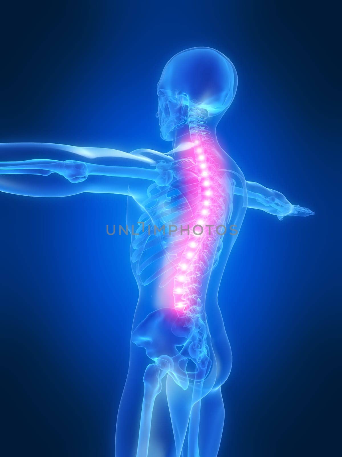 3d rendered anatomy illustration of a human skeleton with a painful spine