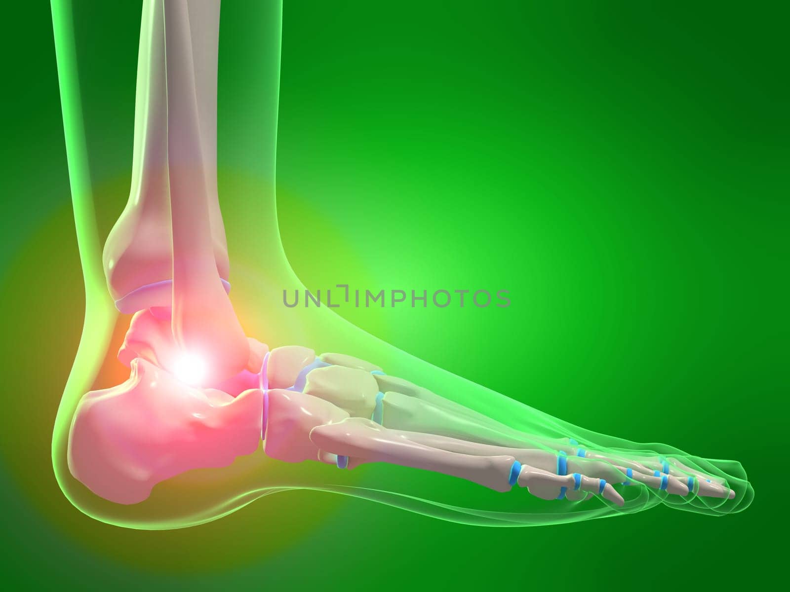 3d rendered x-ray illustration of a human skeletal foot with pain