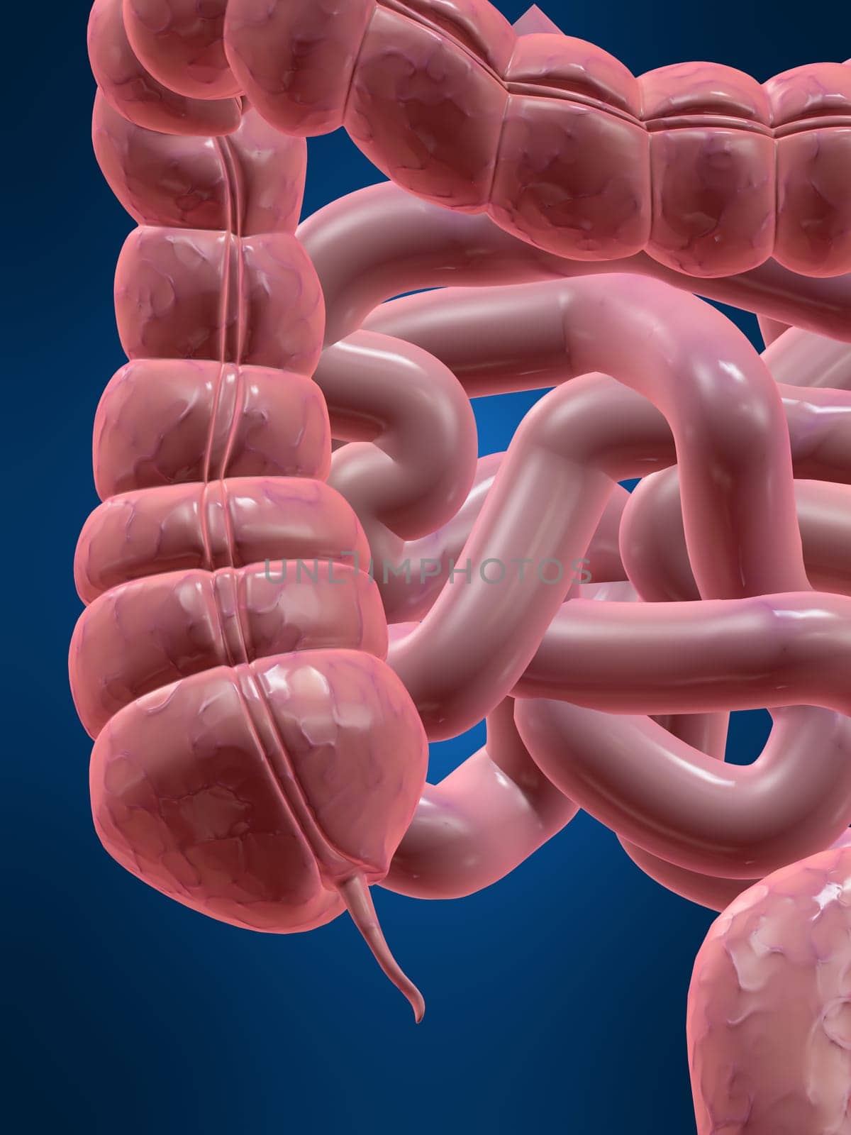 3d rendered anatomy illustration of a human colon with an appendix