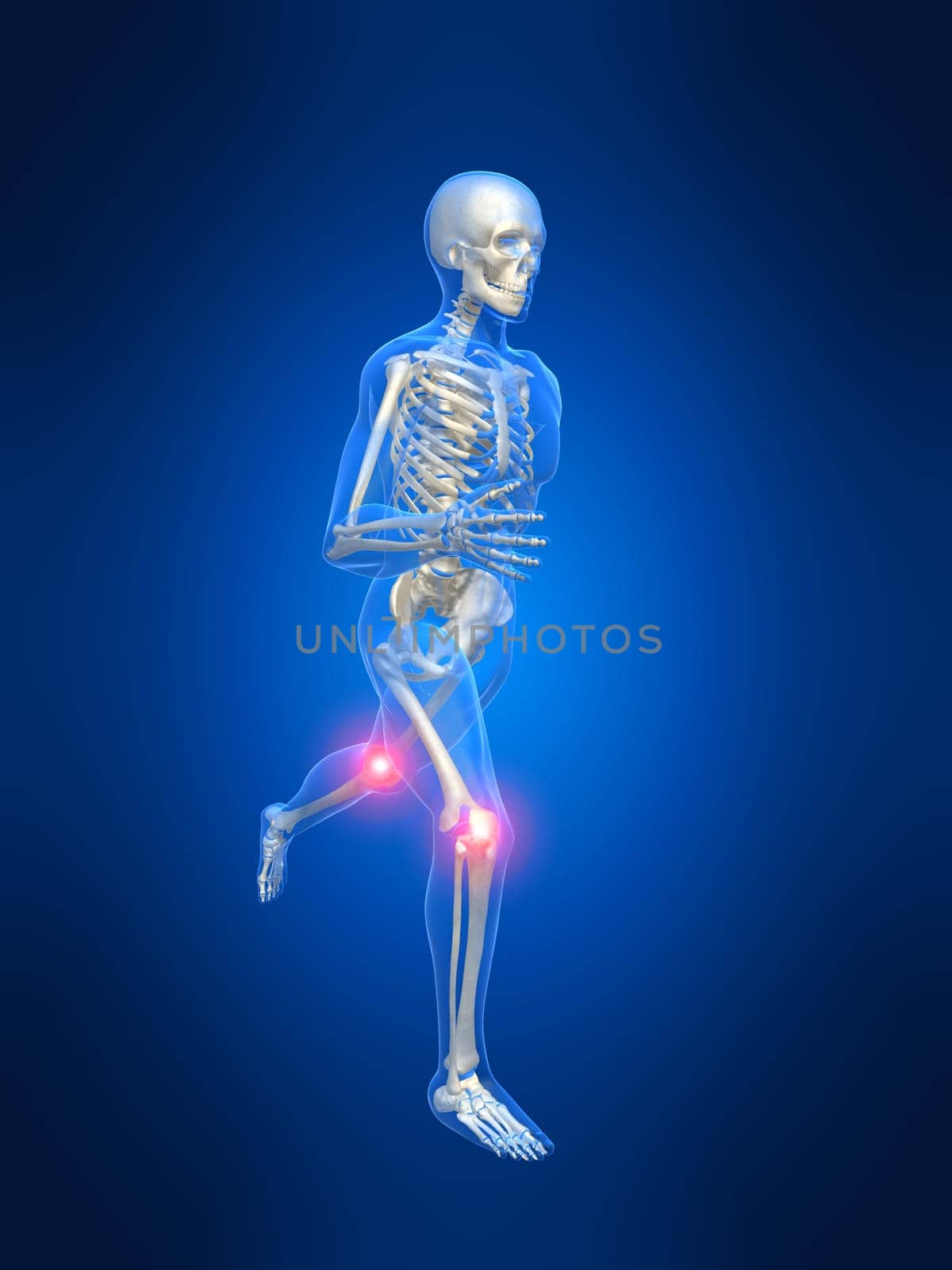 3d rendered anatomy illustration of a running skeleton with painful knees