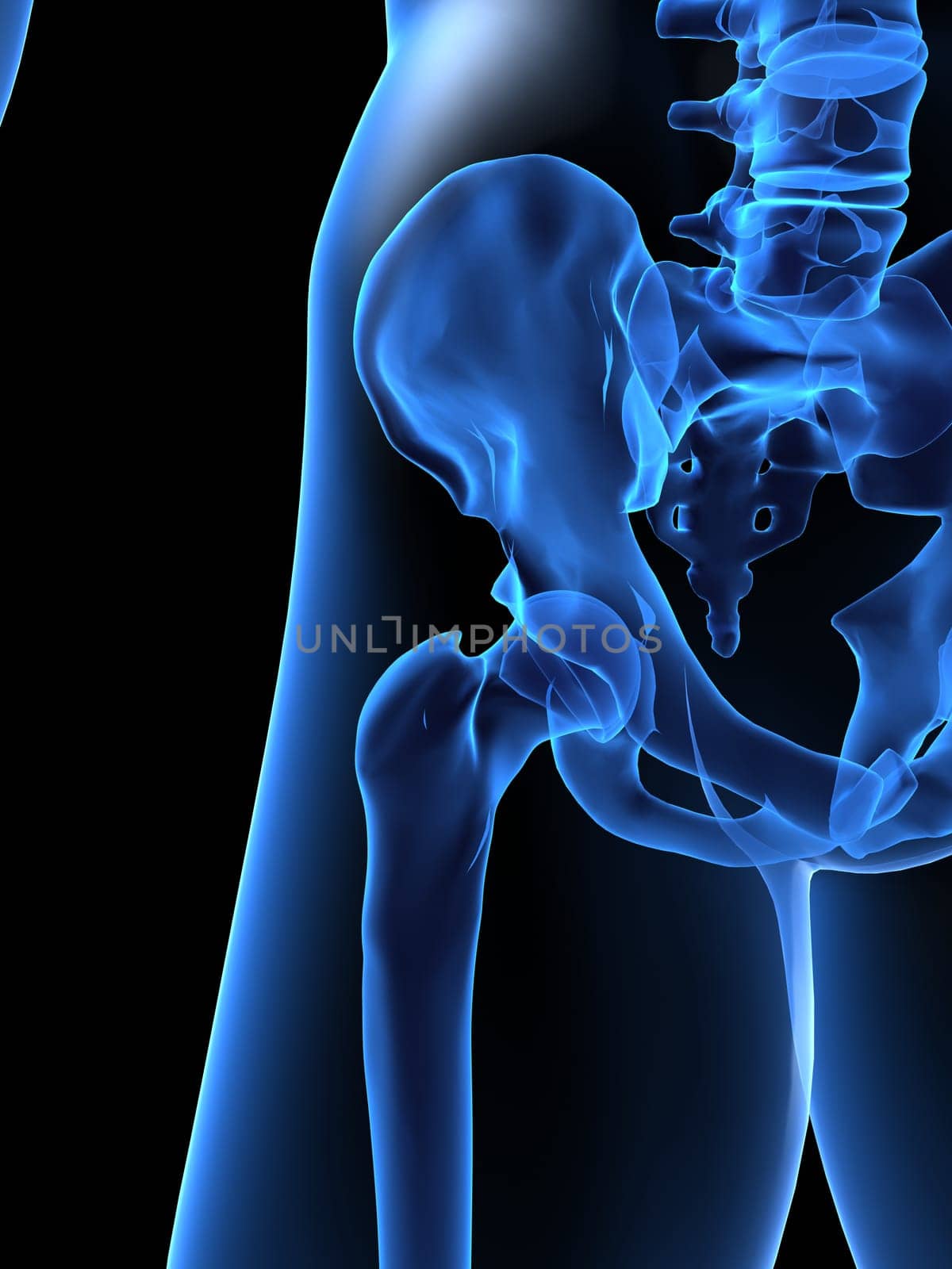 3d rendered x-ray illustration of a human hip
