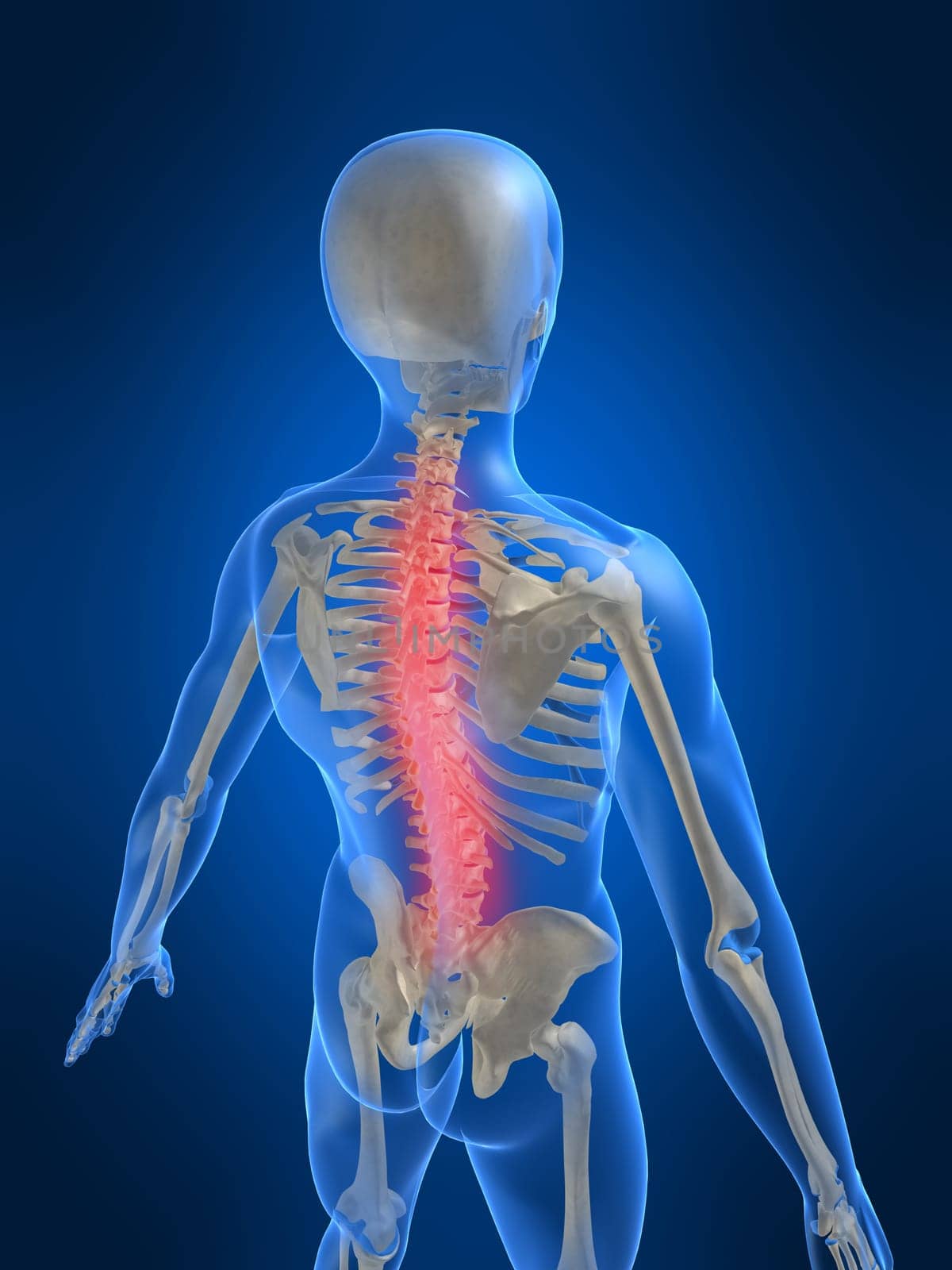 3d rendered anatomy illustration of a human skeleton with a painful spine