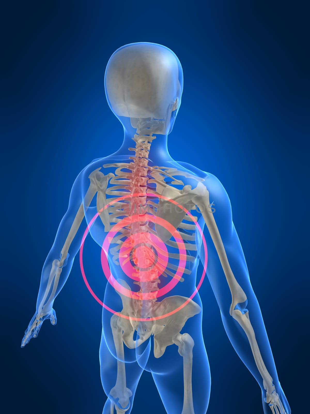 3d rendered anatomy illustration of a human skeleton with a painful spine