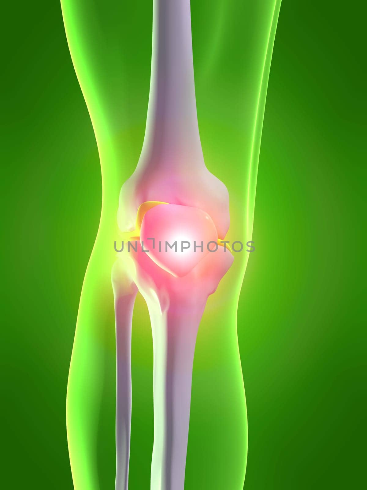 3d rendered anatomy illustration of a human skeletal knee with pain