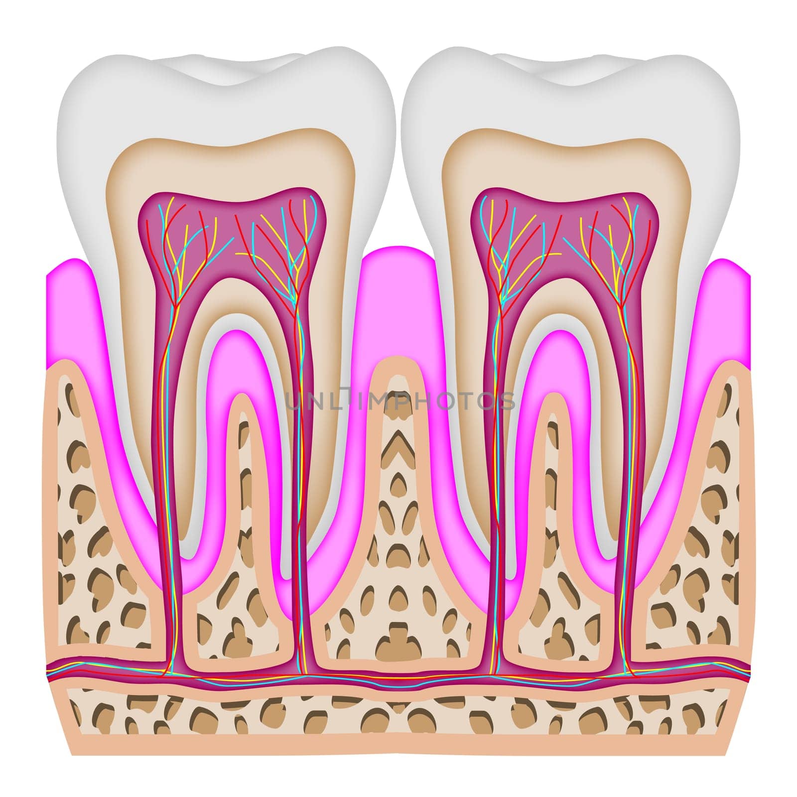Illustration of the intersection of two teeth.