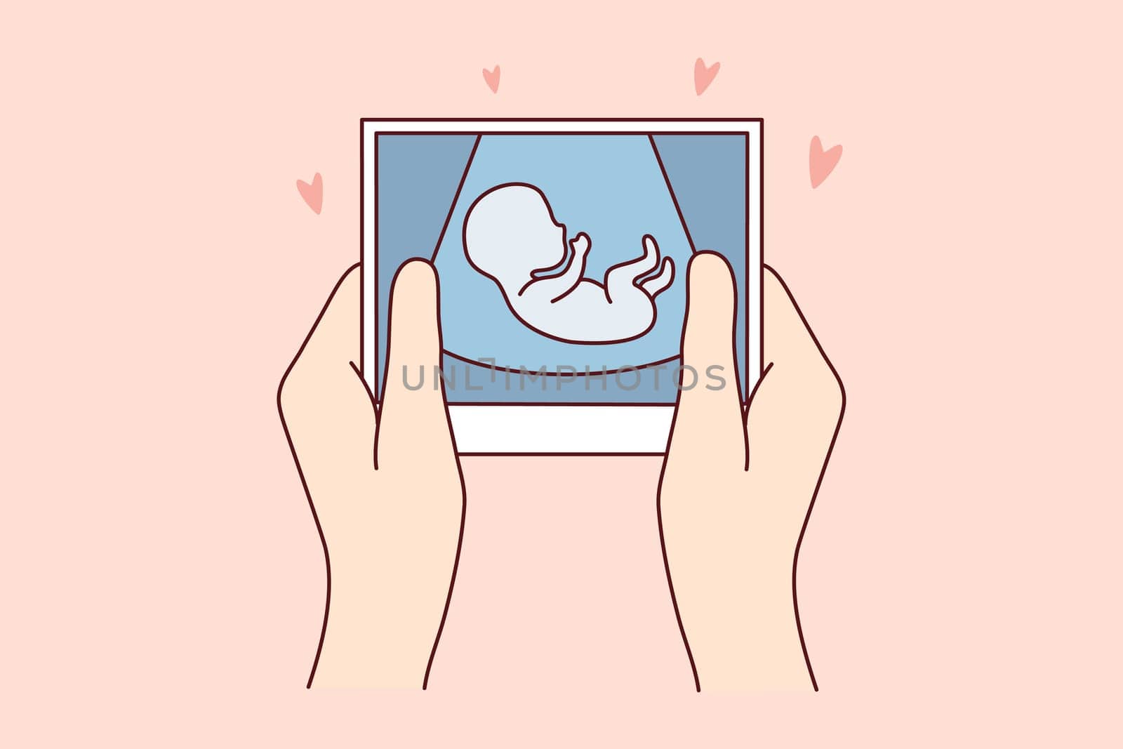 Hands of person holding scan of embryo waiting for baby birth. Future mother with ultrasound picture of baby. Motherhood concept. Vector illustration.